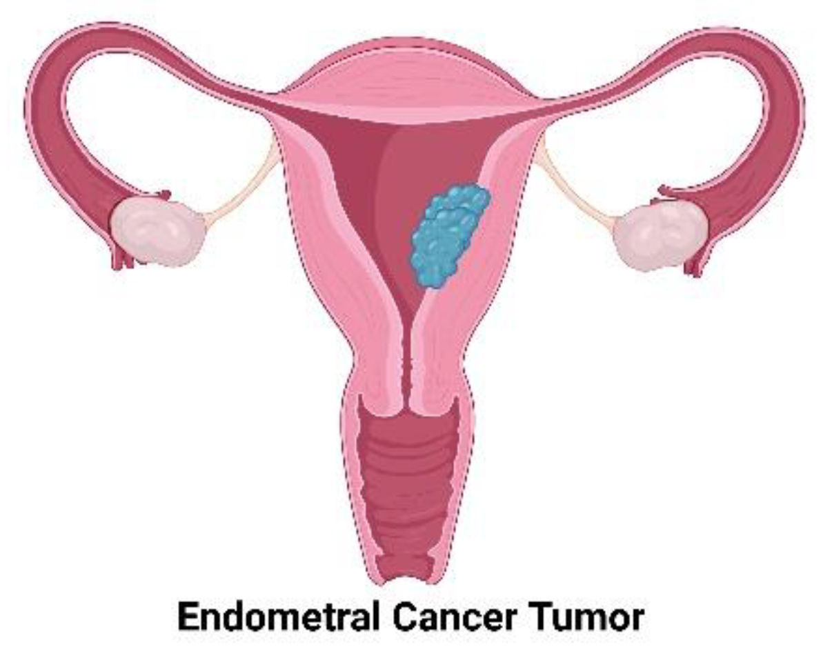 Cancers 13 02351 g003 Cancers 13 02351 g003