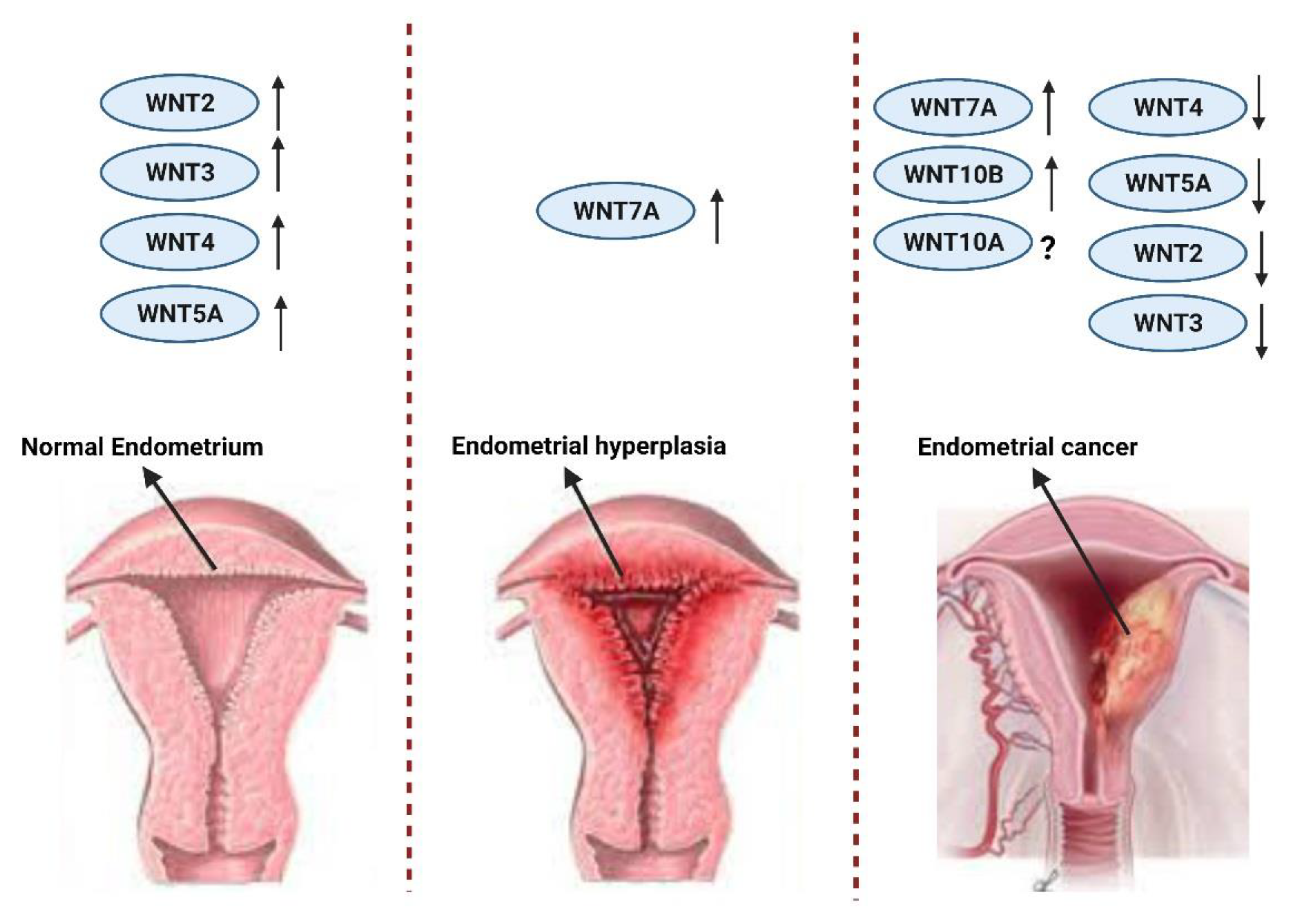 endometrial cancer tumor marker suplimente detoxifiante pentru opiacee