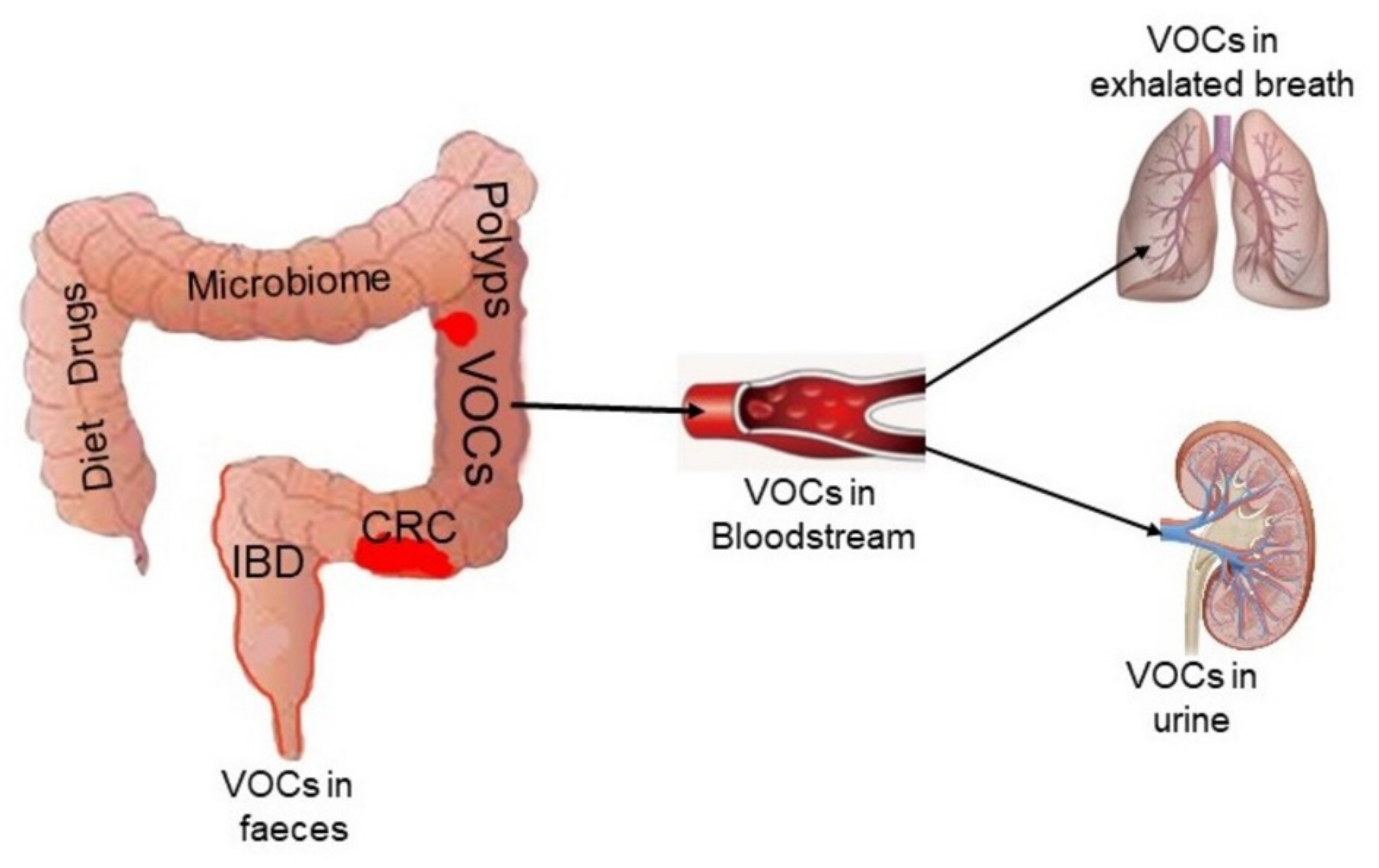 Cancers 13 02361 g001 Cancers 13 02361 g001