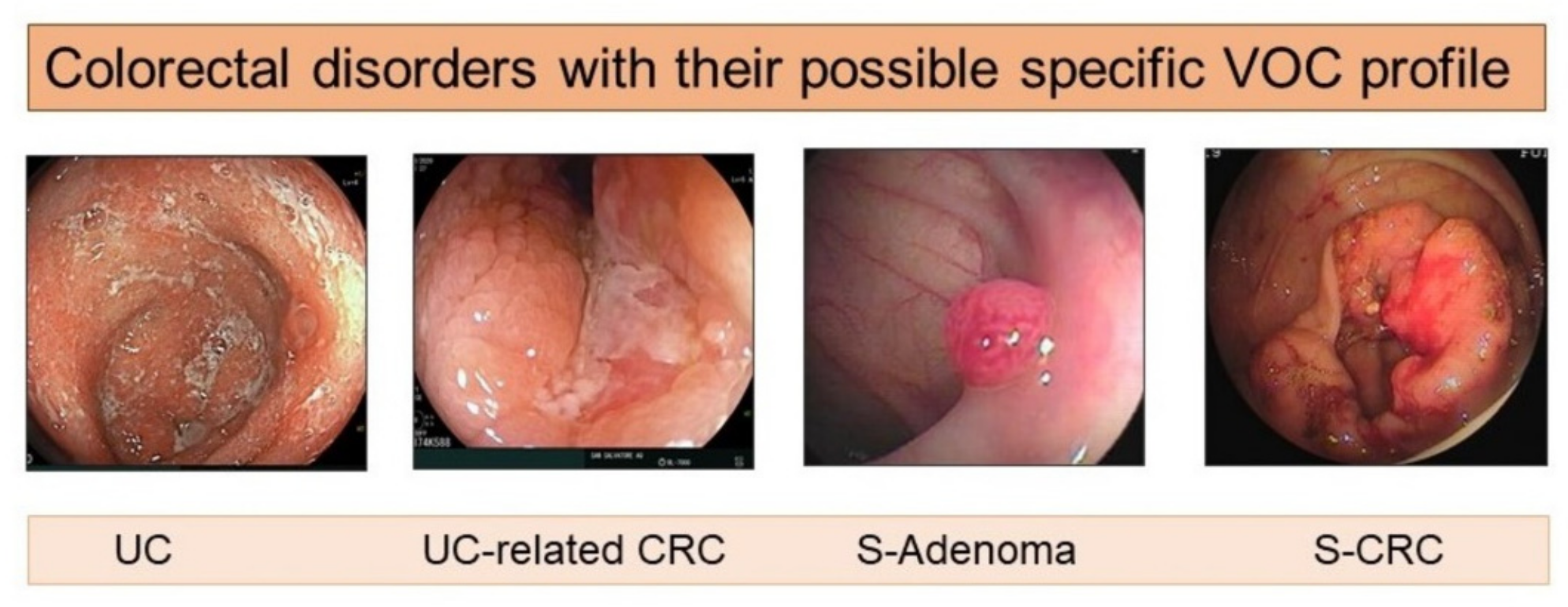 Cancers 13 02361 g003 Cancers 13 02361 g003