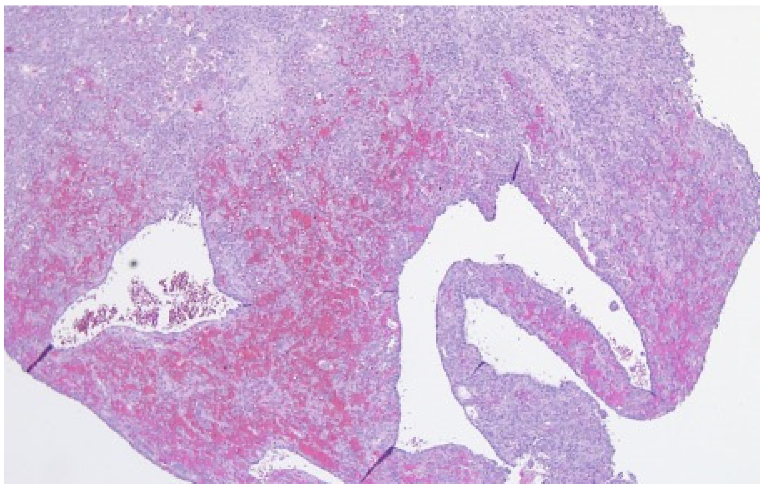 Cancers 13 02362 g001 Cancers 13 02362 g001