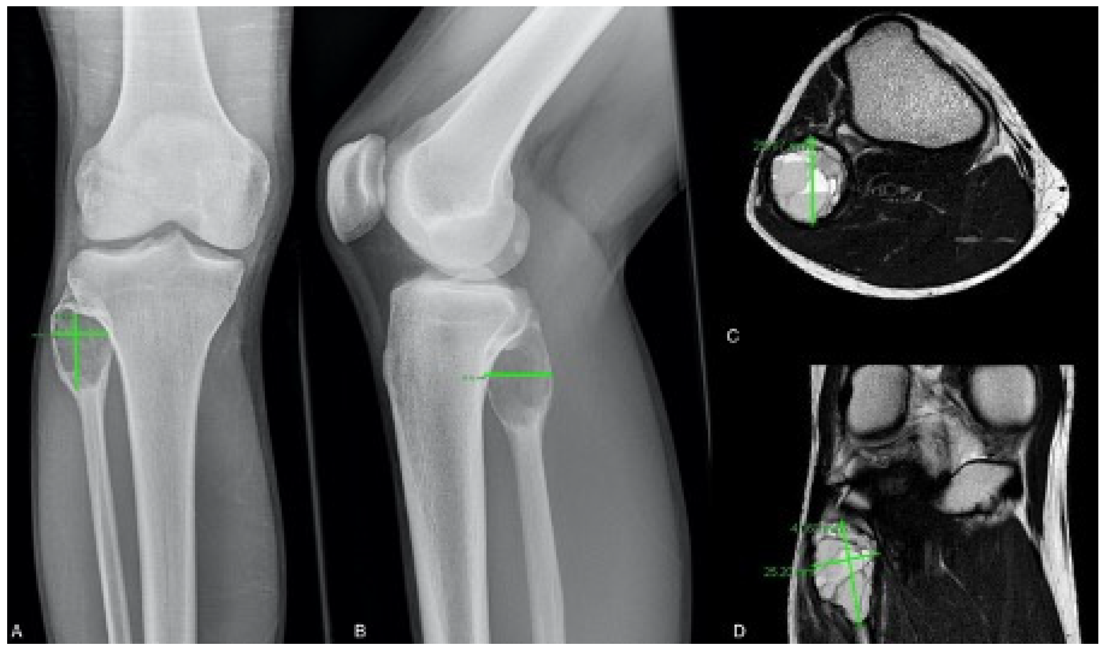 Cancers 13 02362 g002 Cancers 13 02362 g002