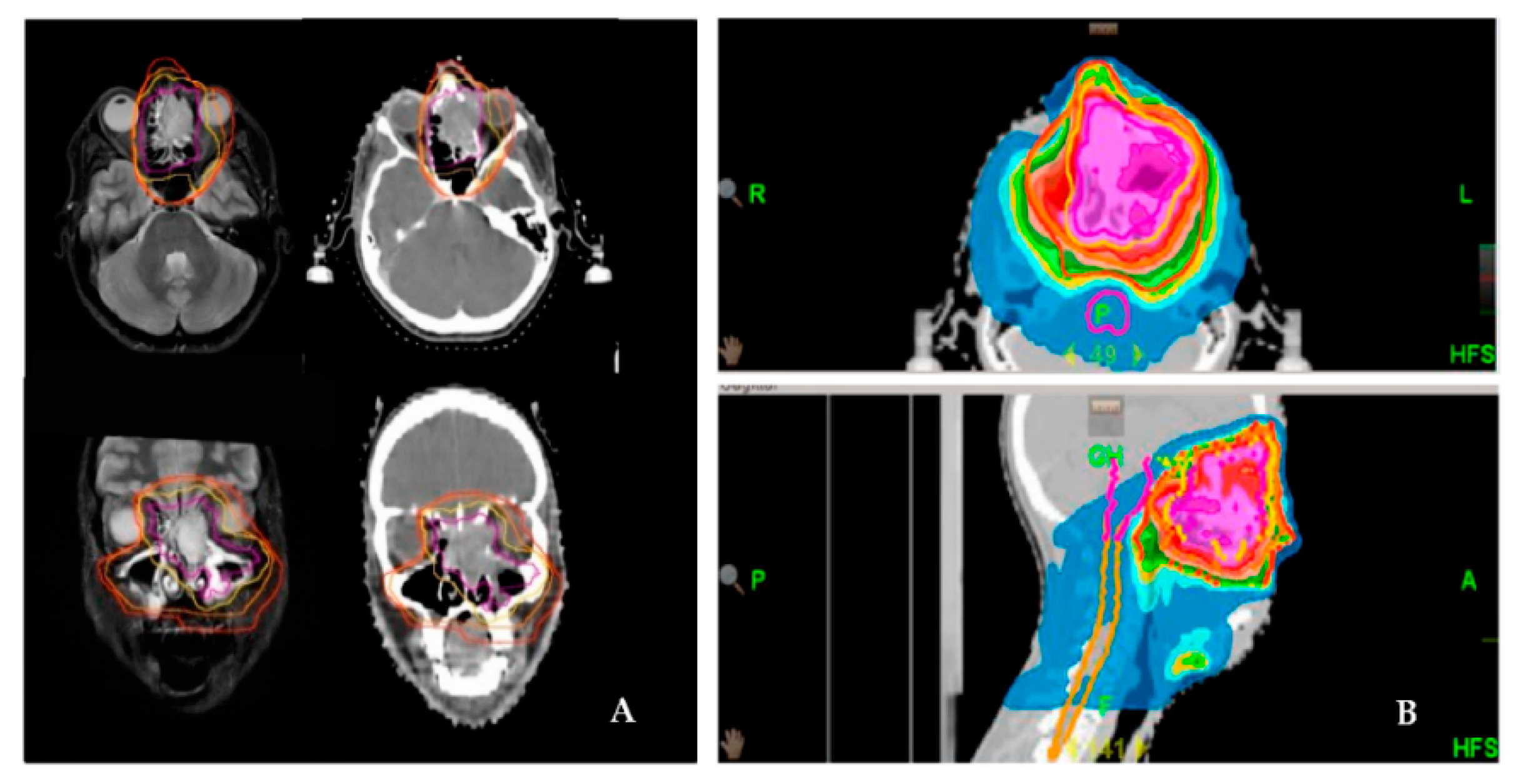 Cancers 13 02364 g001