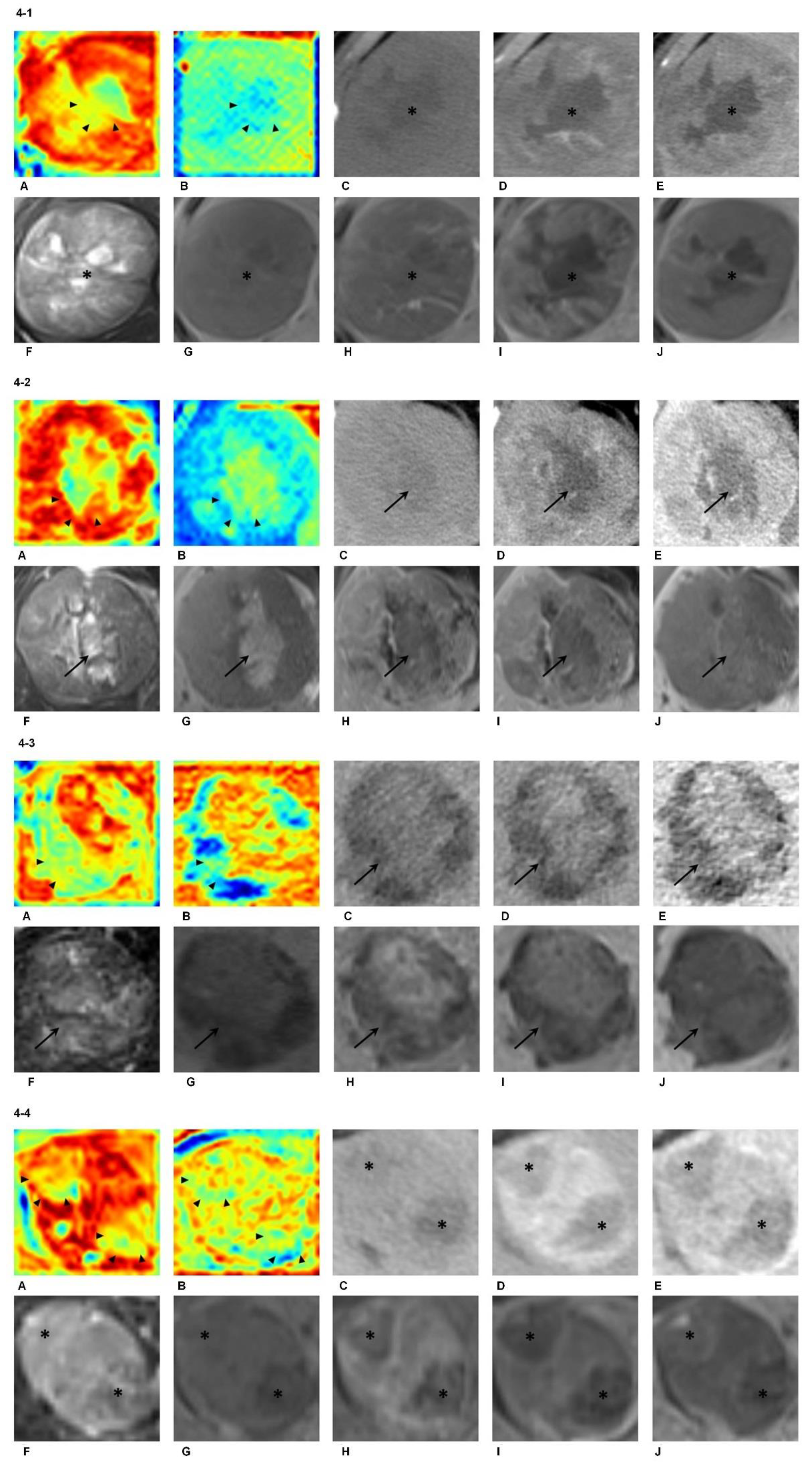 Cancers 13 02368 g004 Cancers 13 02368 g004