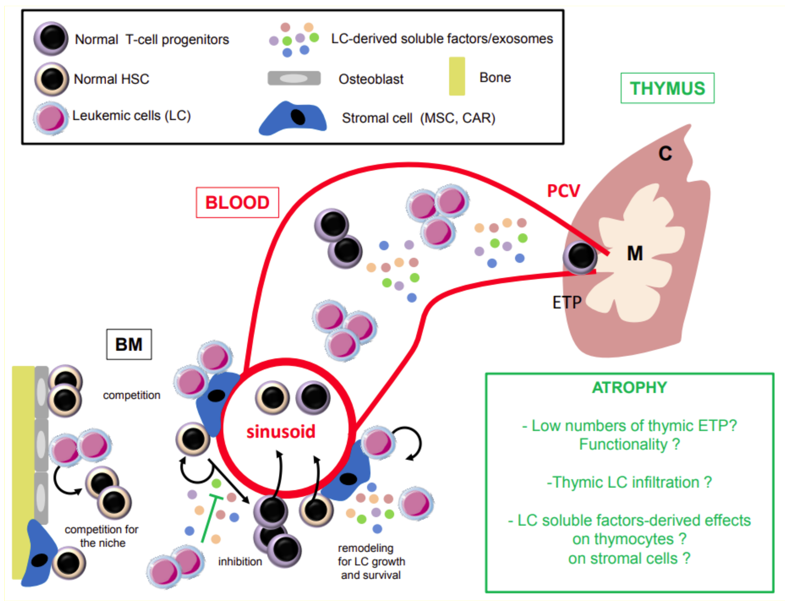 Cancers Free Full Text Acute Myeloid Leukemia Is It T Time Html