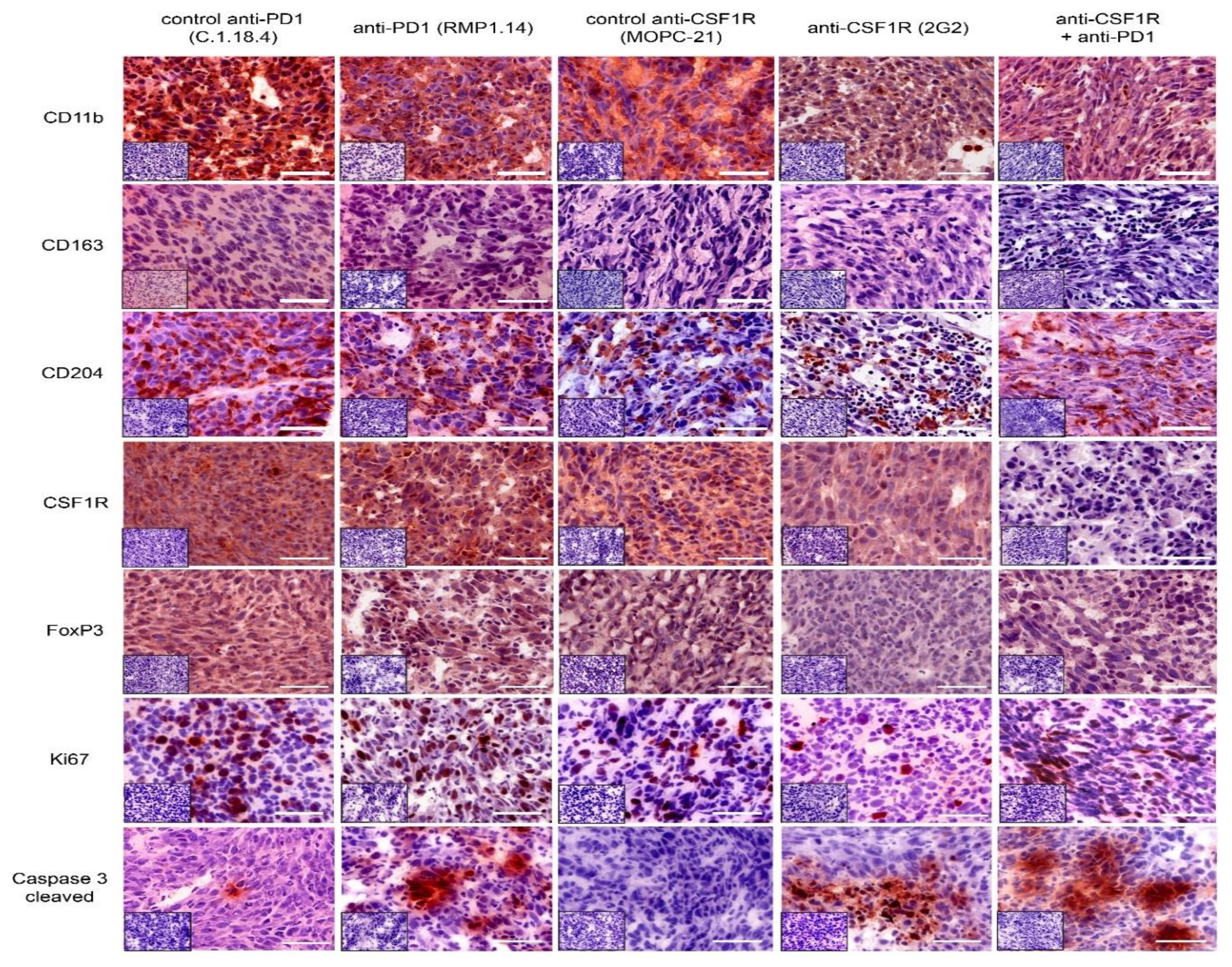 Cancers 13 02400 g004