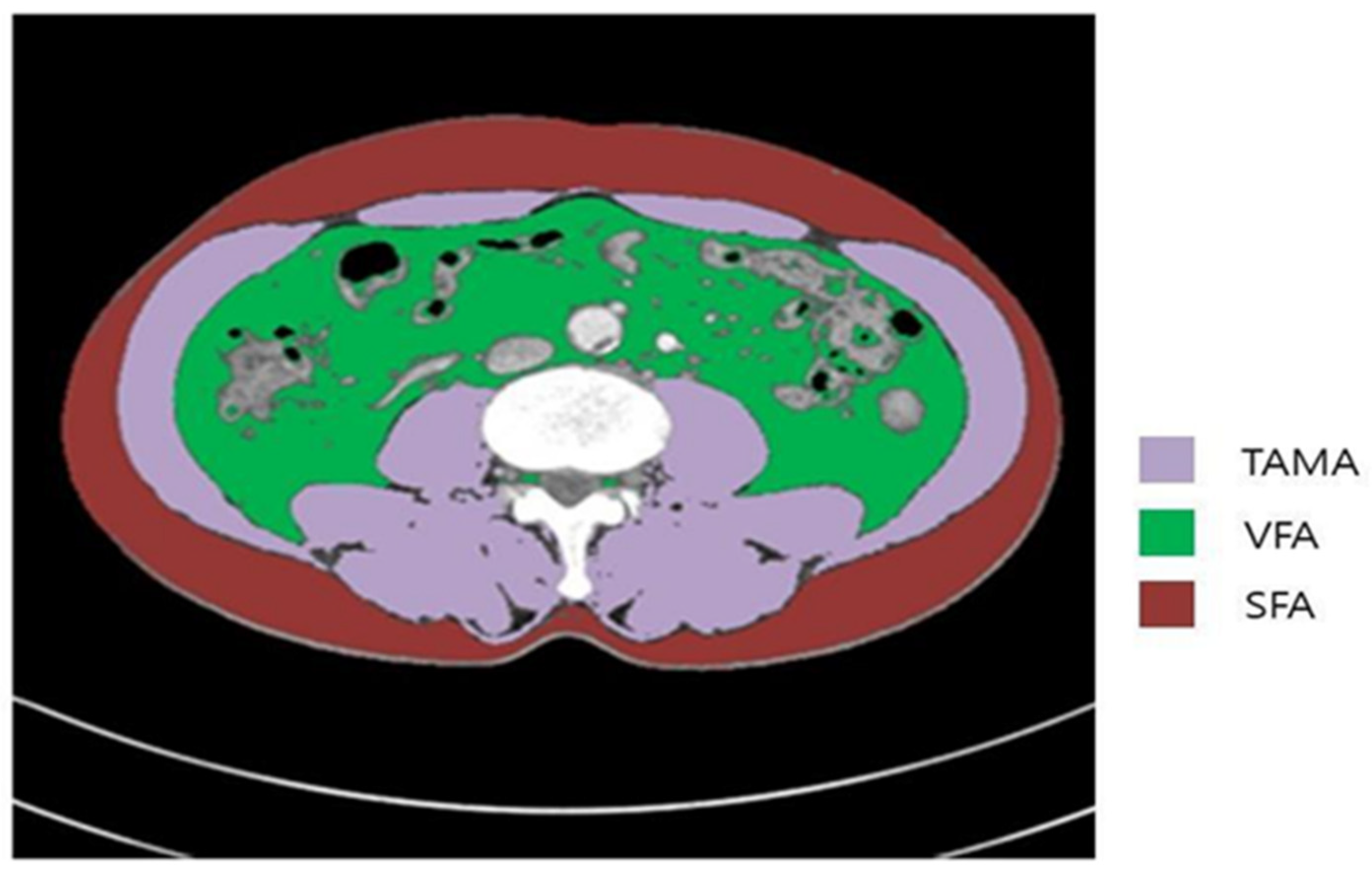 Cancers 13 02410 g002 Cancers 13 02410 g002