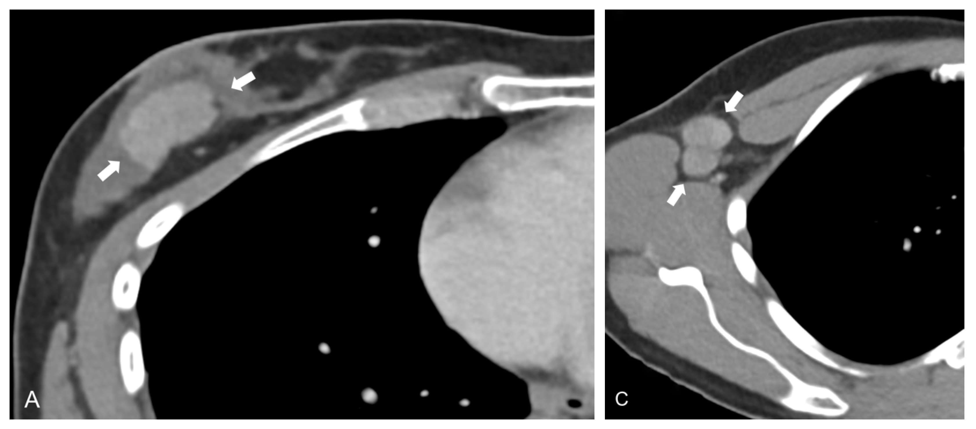 Cancers 13 02431 g002a Cancers 13 02431 g002a