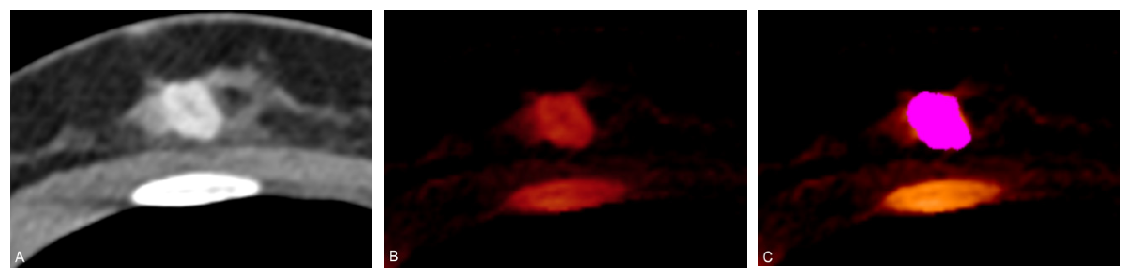 Cancers 13 02431 g003 Cancers 13 02431 g003