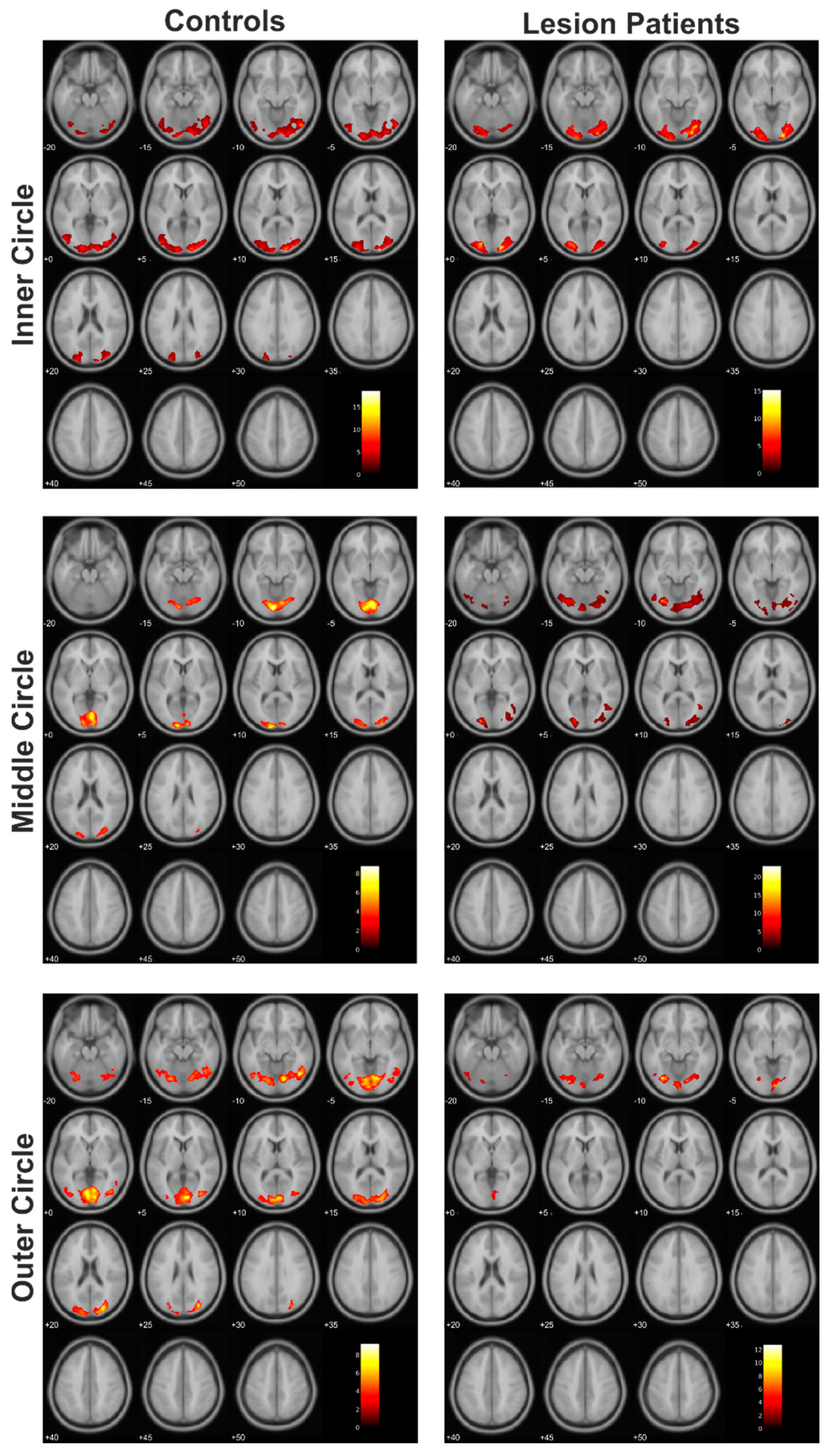 Cancers 13 02439 g004 Cancers 13 02439 g004