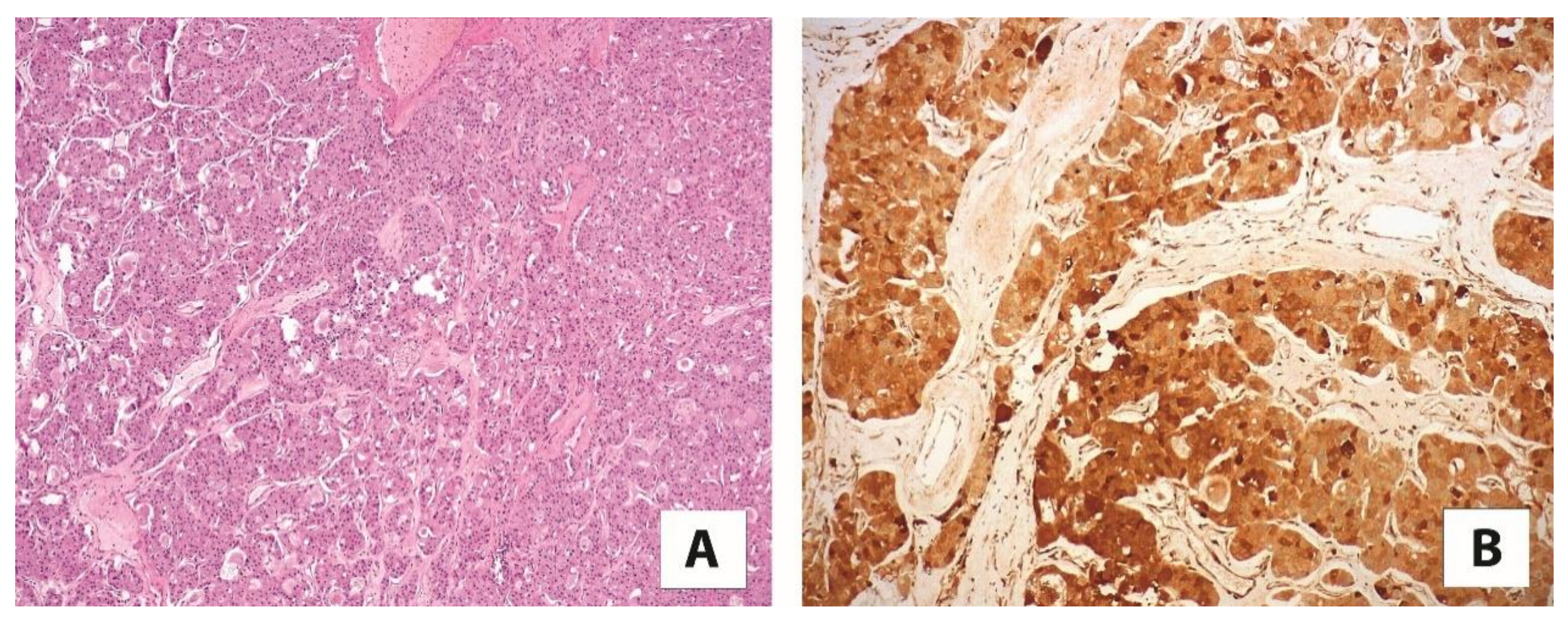 Cancers 13 02441 g005