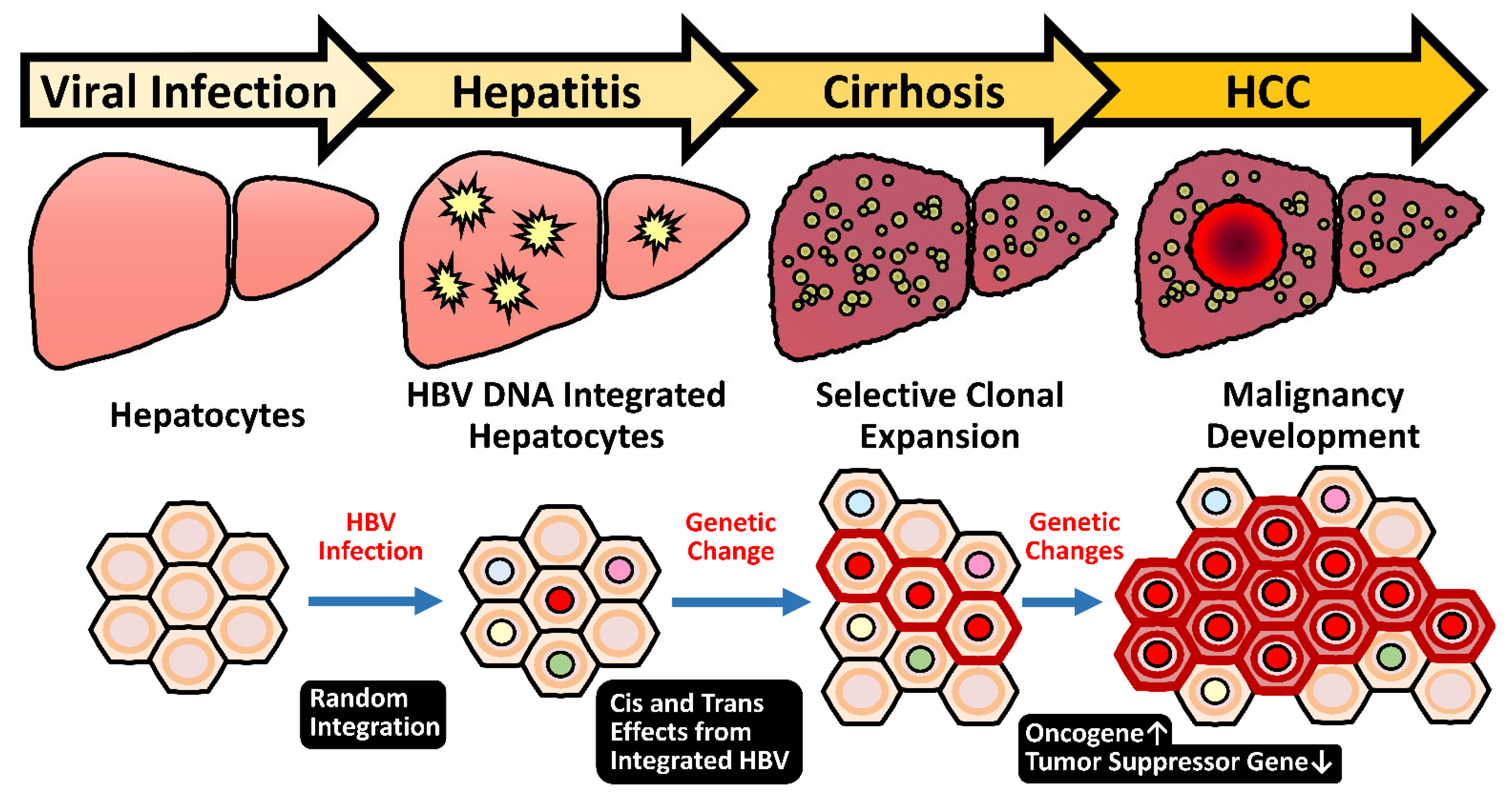 Pathogenesis of liver cancer - vrogue.co