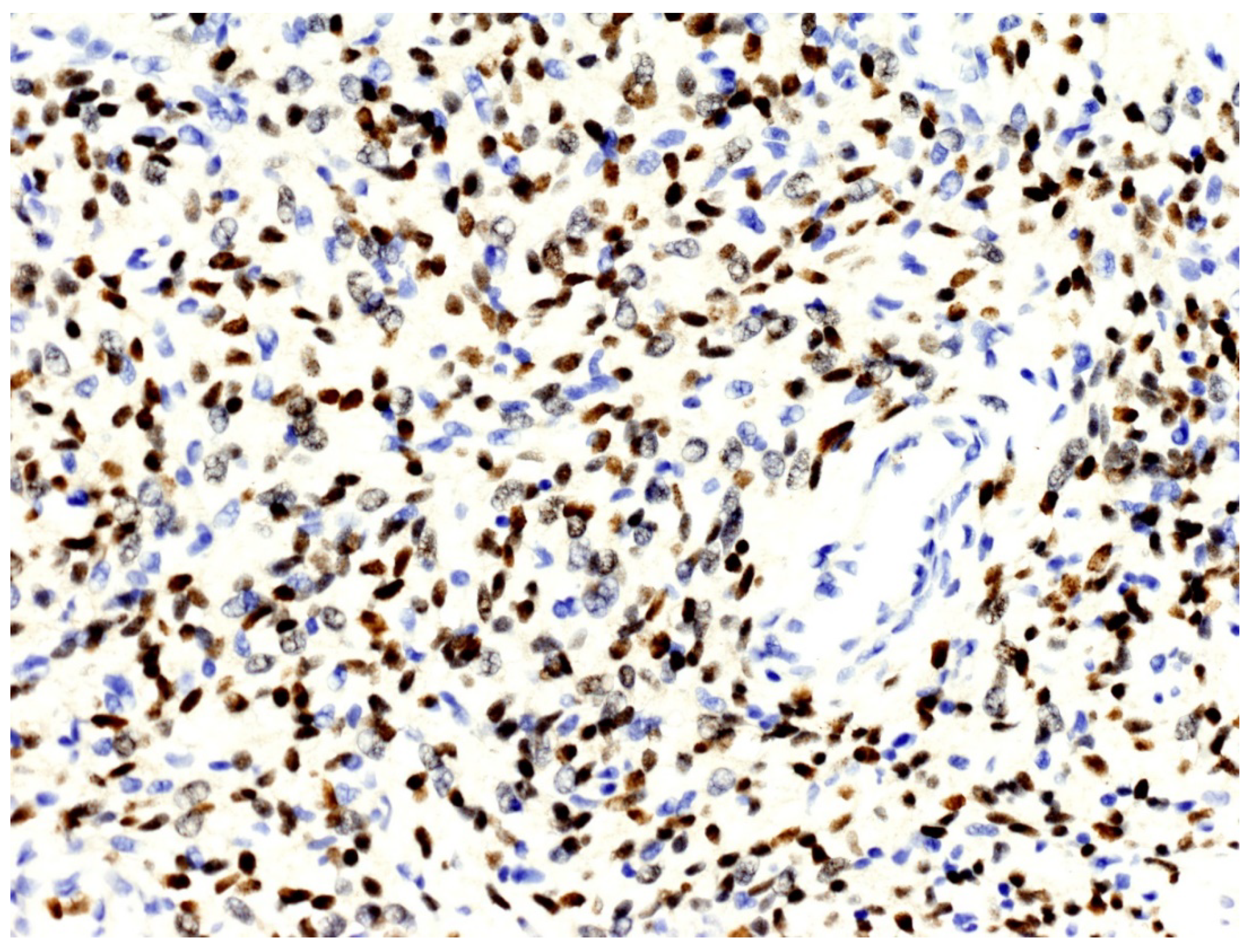 Cancers 13 02470 g002