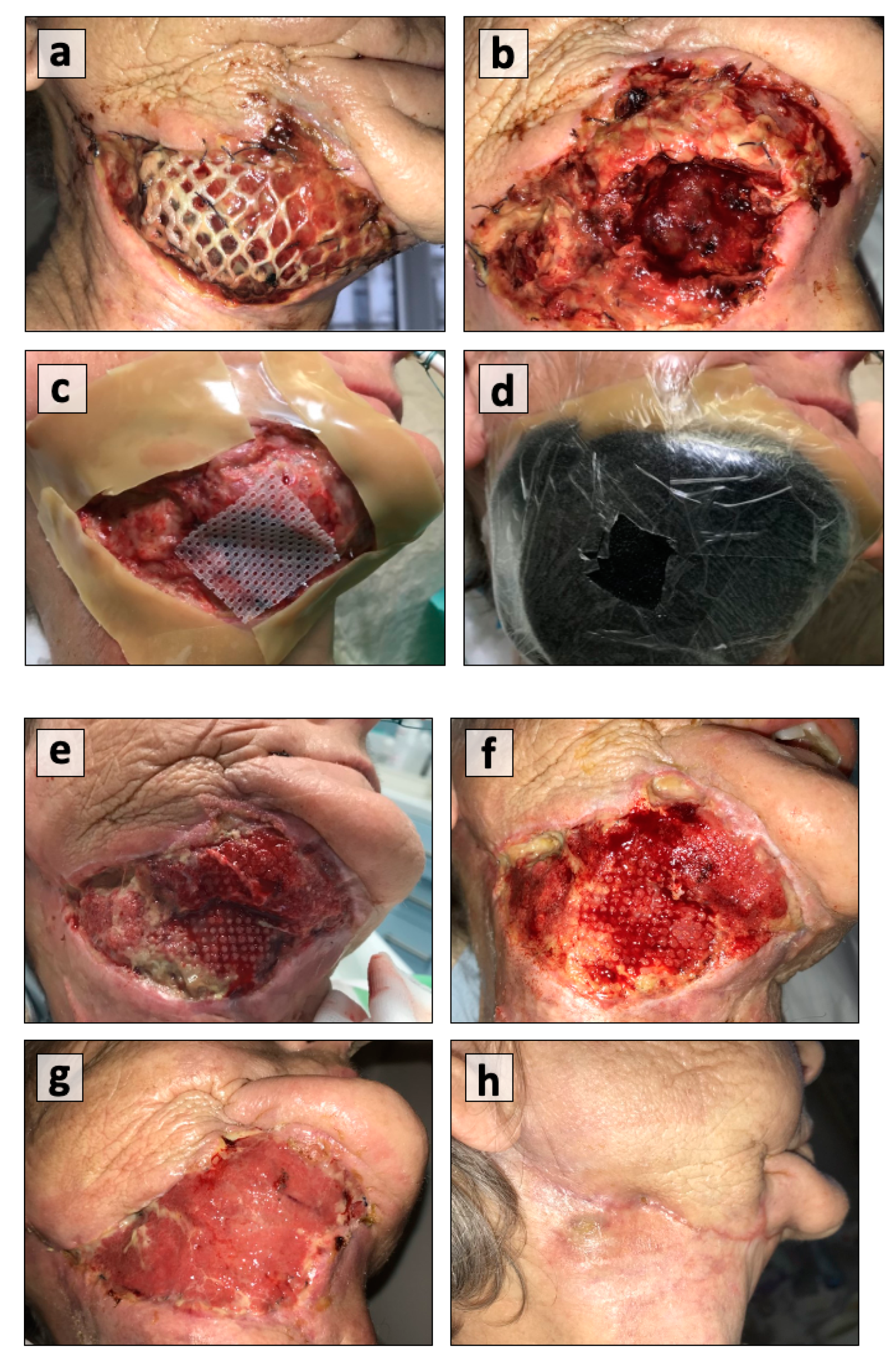 Cancers 13 02482 g003 Cancers 13 02482 g003