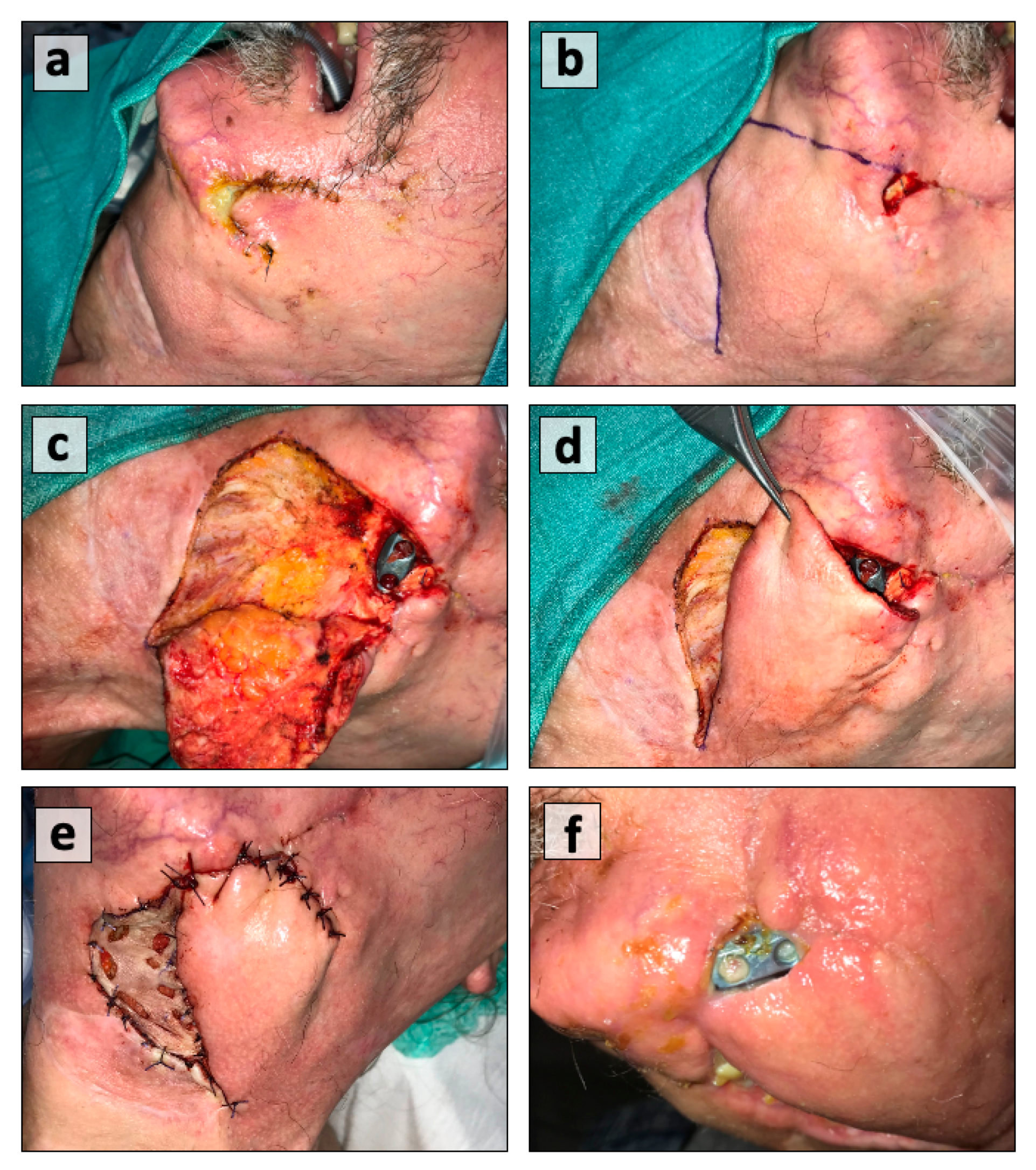 Cancers 13 02482 g004 Cancers 13 02482 g004