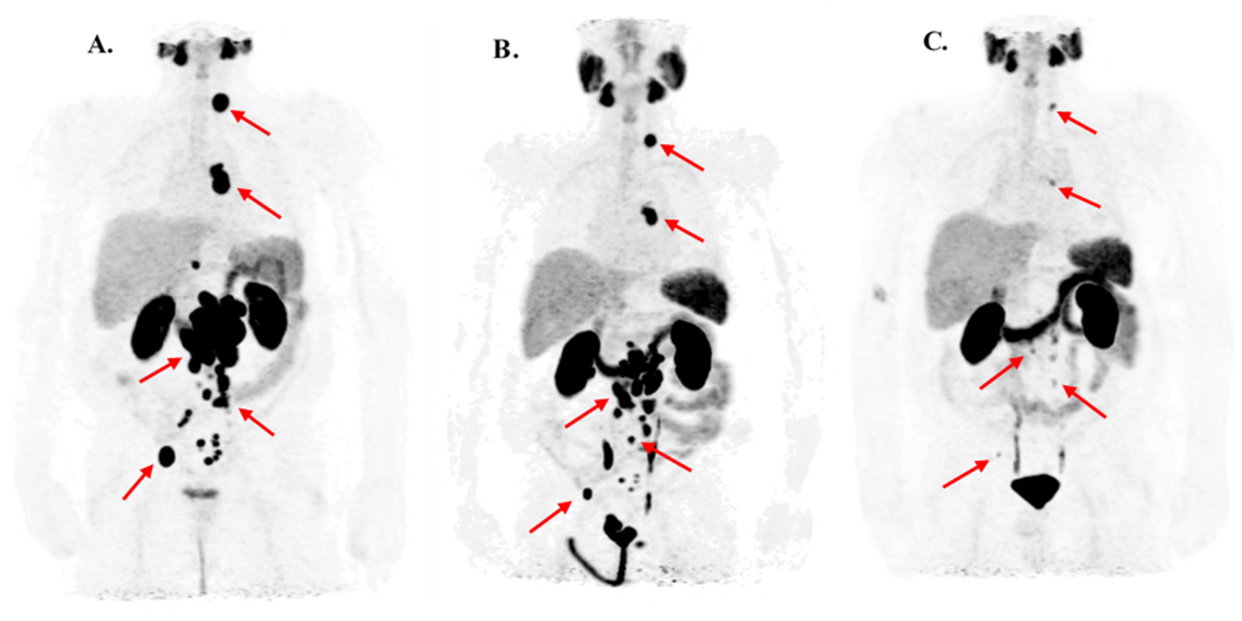 Cancers 13 02489 g004 Cancers 13 02489 g004