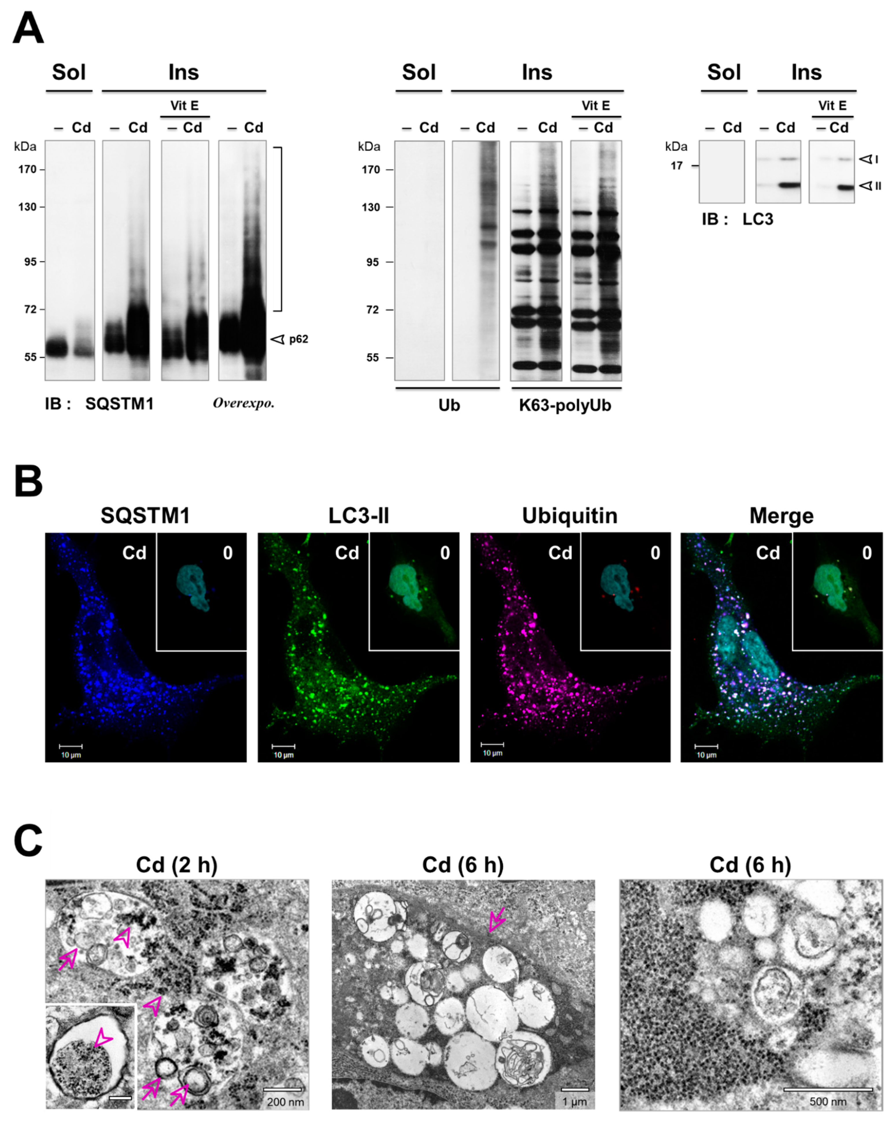 Cancers 13 02490 g005 Cancers 13 02490 g005