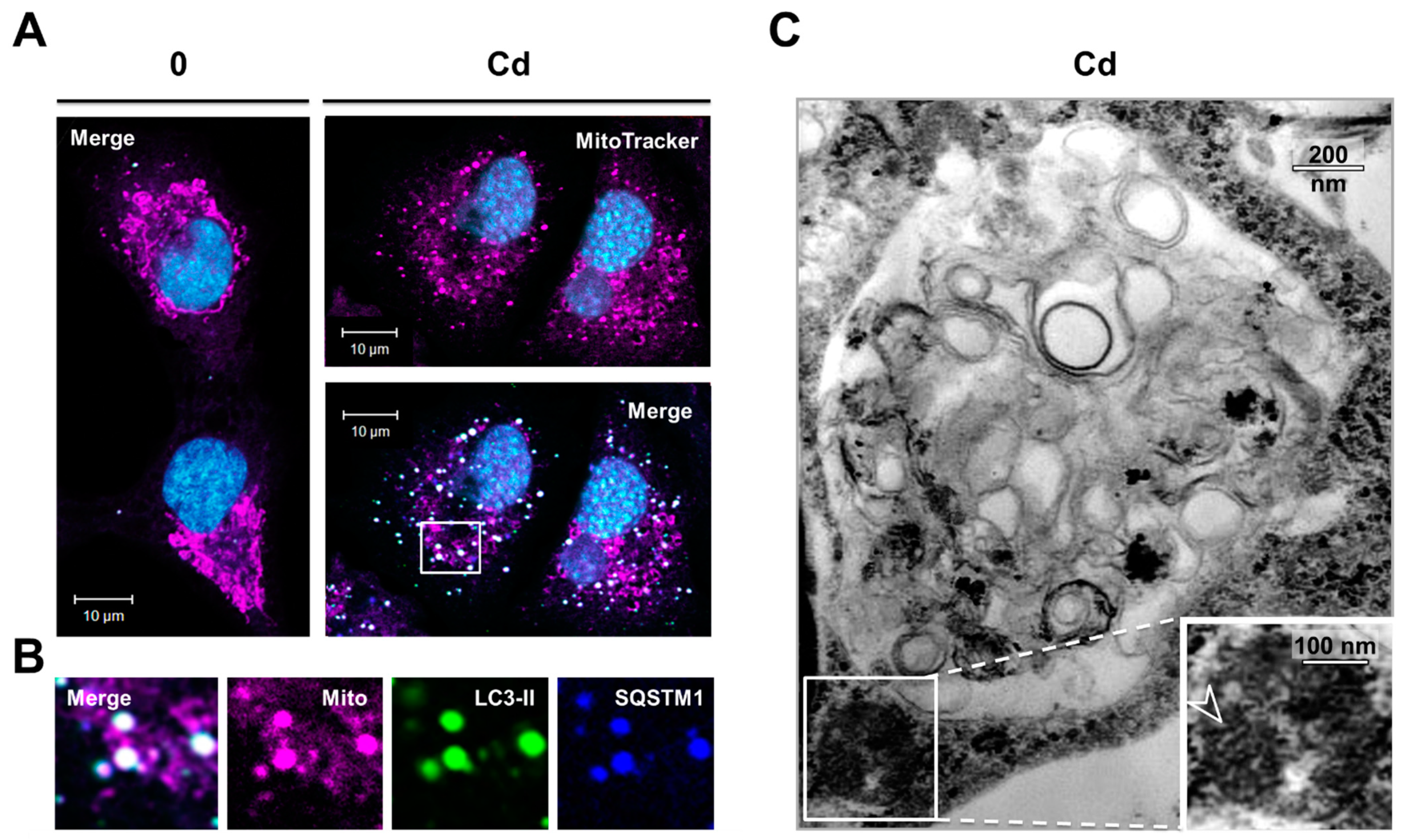 Cancers 13 02490 g006 Cancers 13 02490 g006