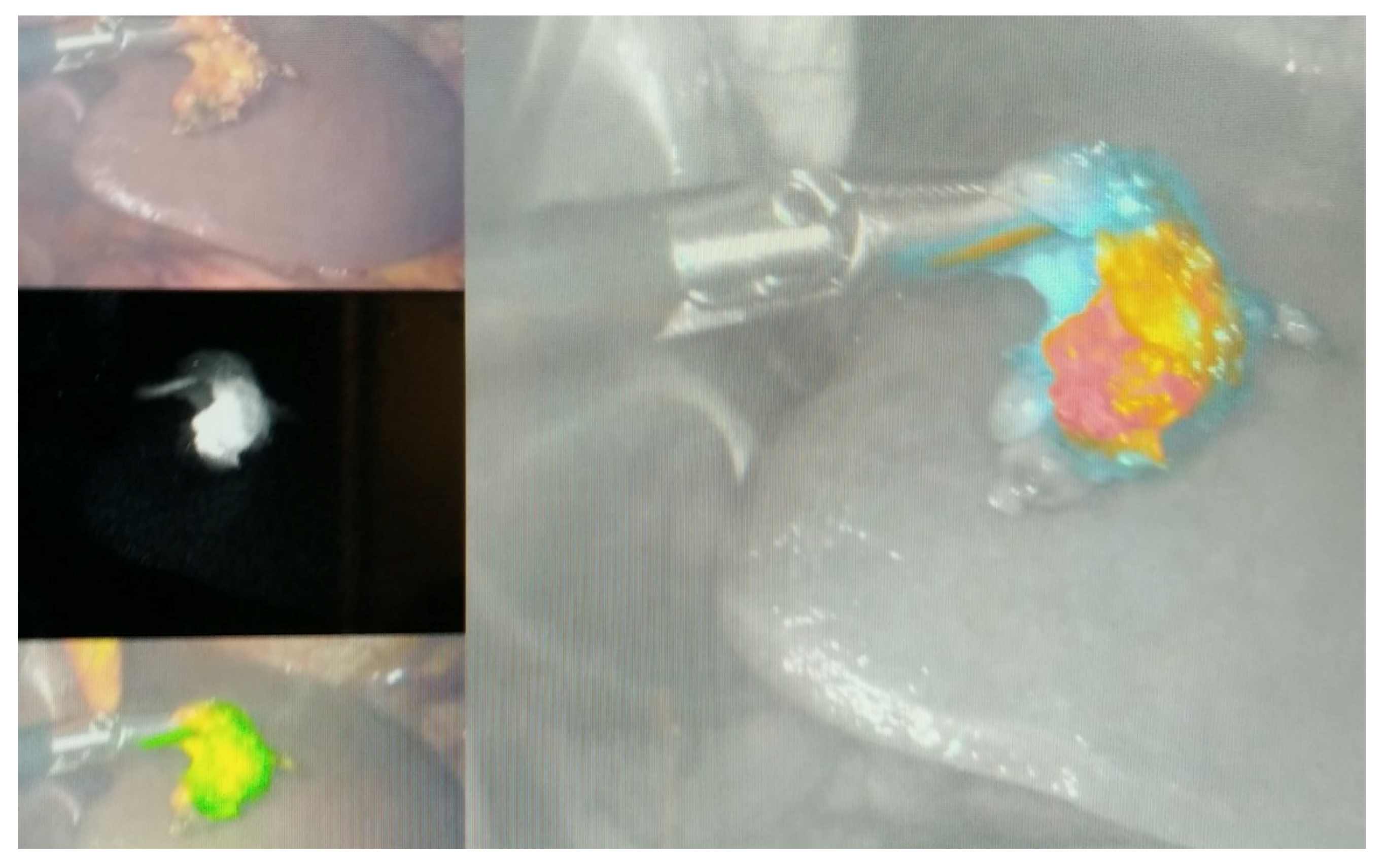 Cancers 13 02509 g001 Cancers 13 02509 g001