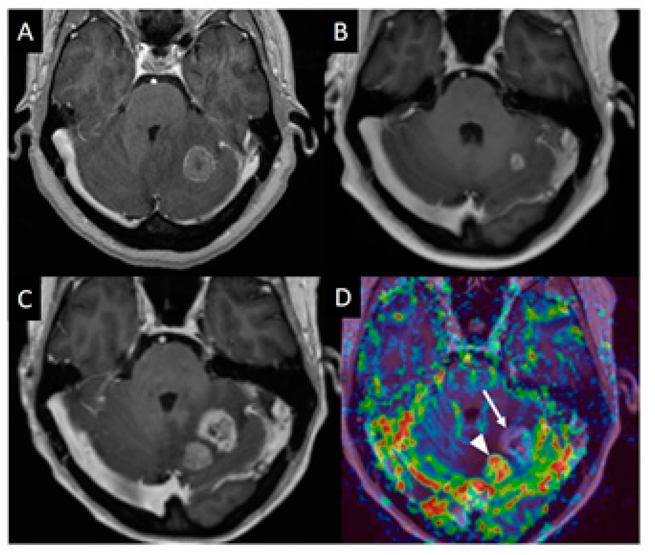 Cancers 13 02557 g001