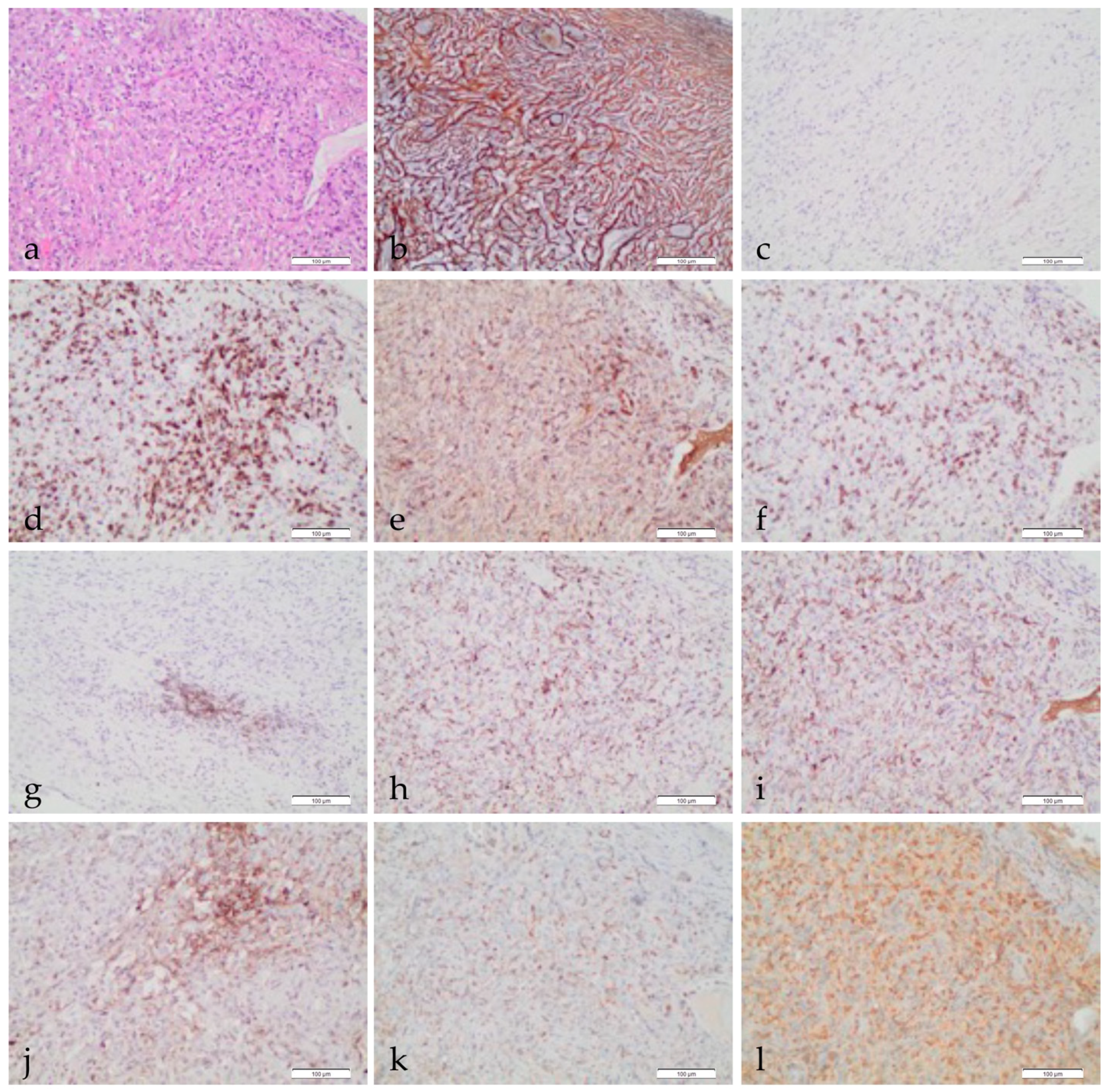 Cancers 13 02564 g001 Cancers 13 02564 g001