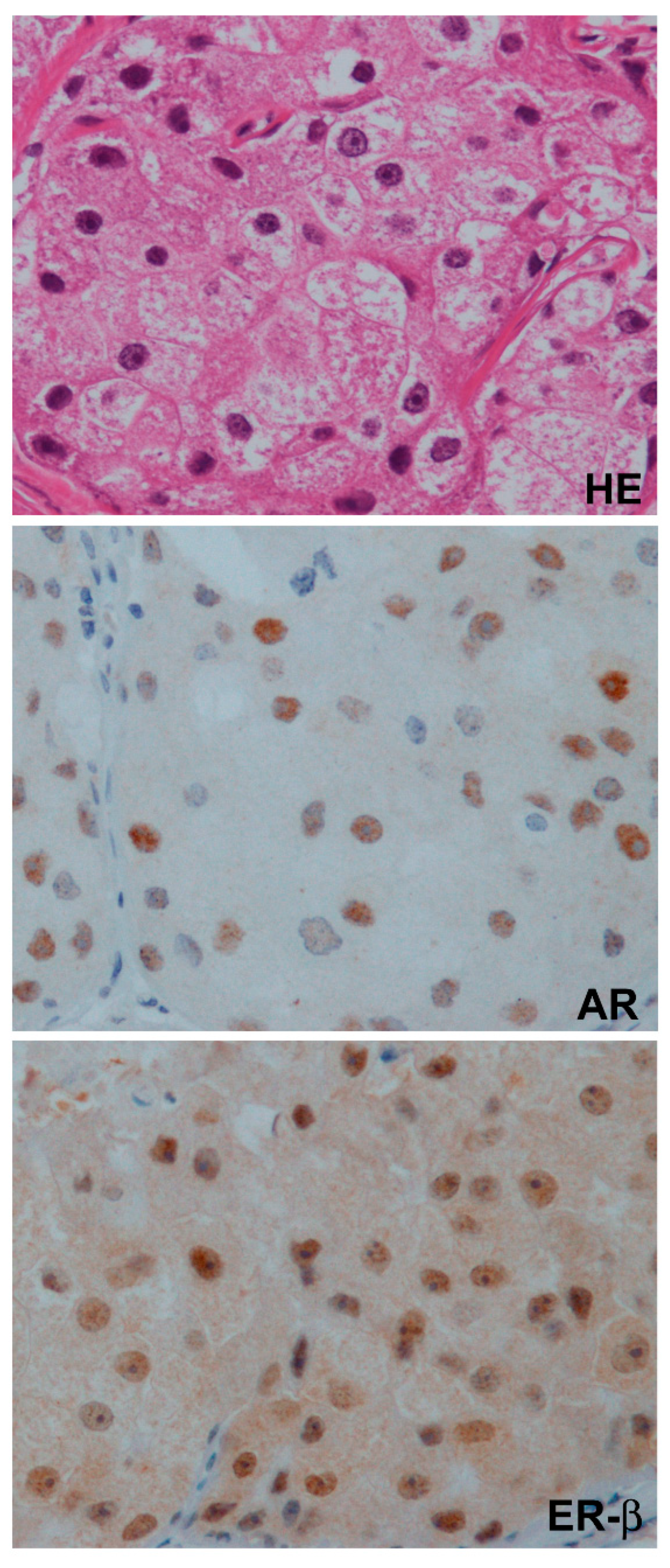 Cancers 13 02588 g004 Cancers 13 02588 g004