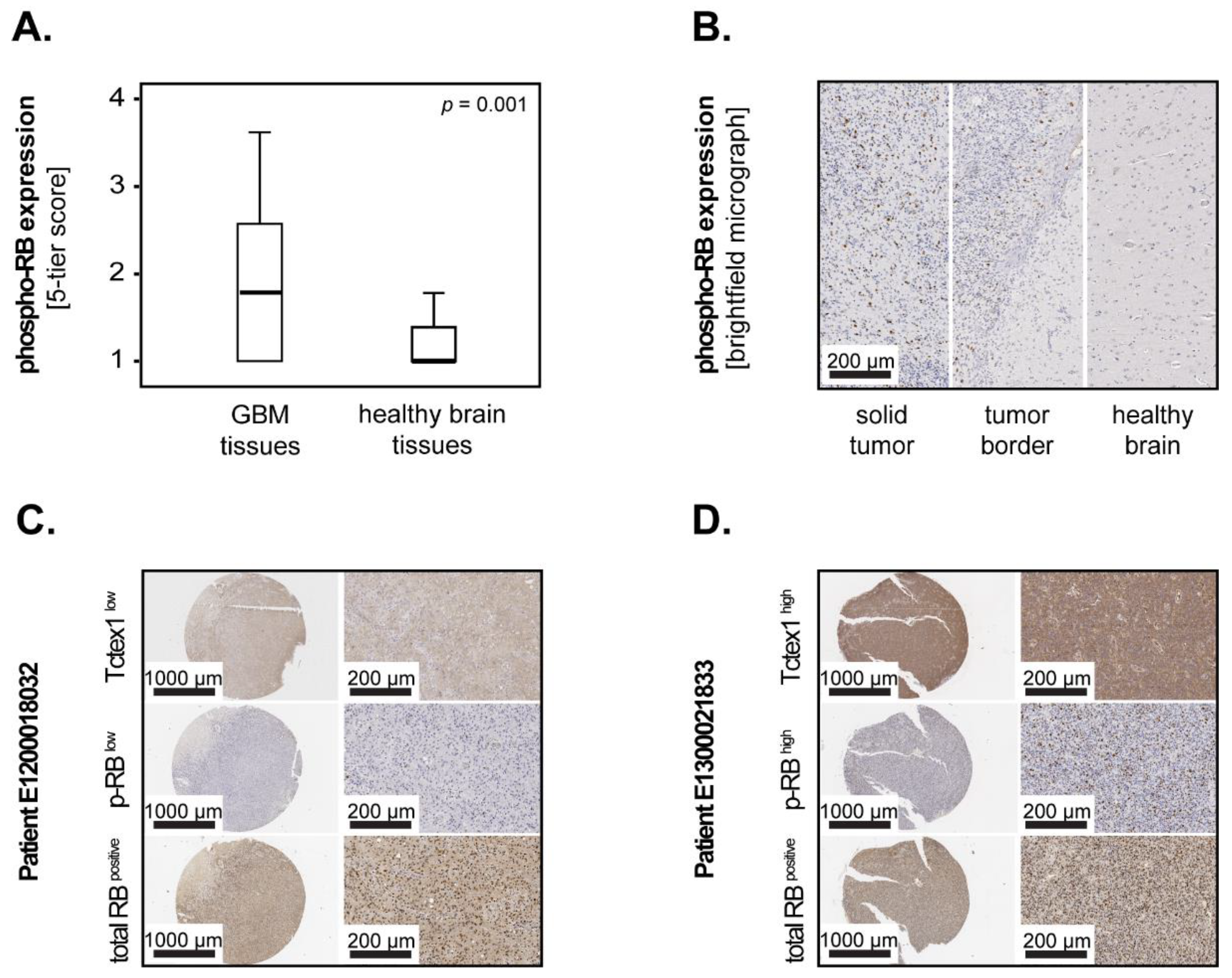 Cancers 13 02624 g005