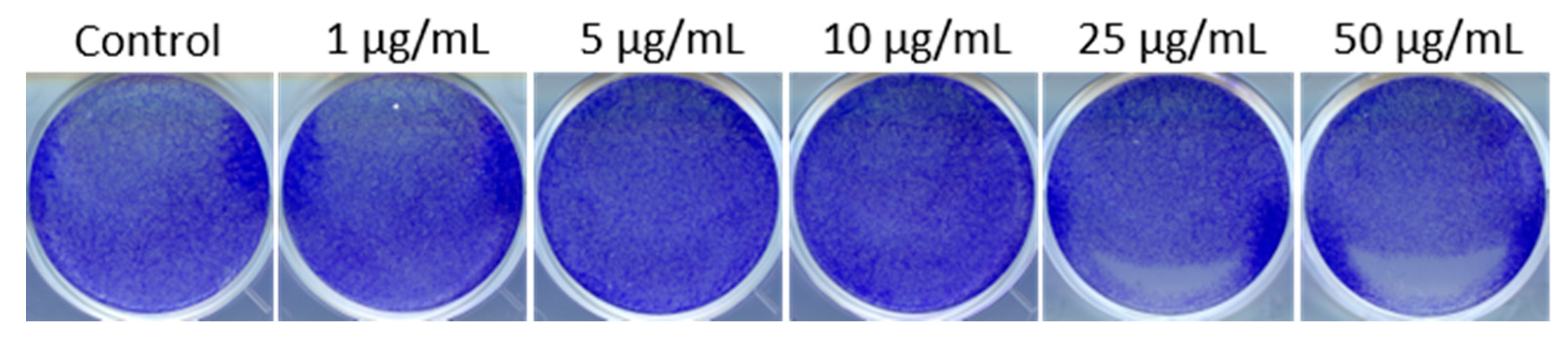 Cancers 13 02631 g004 Cancers 13 02631 g004