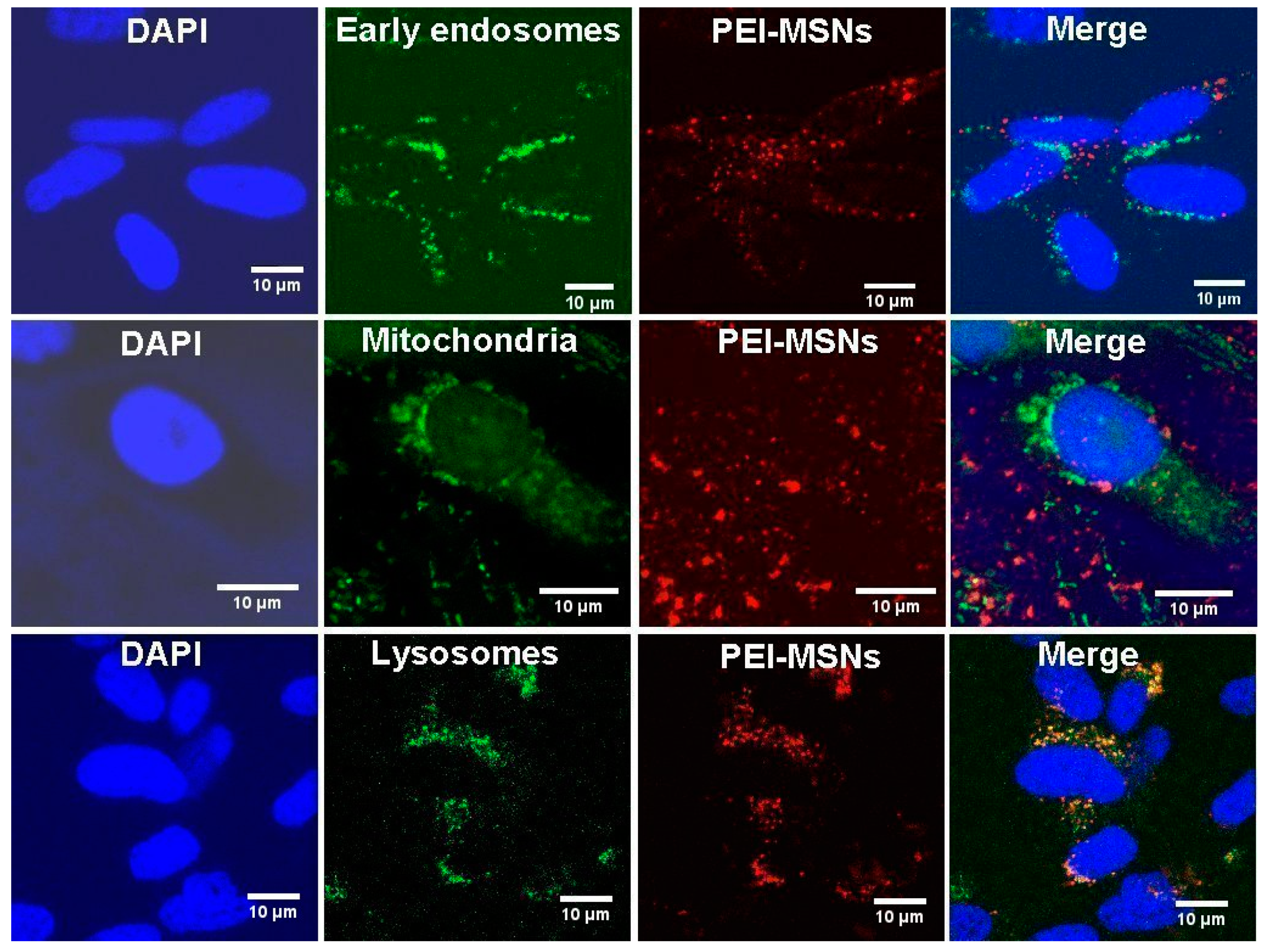 Cancers 13 02631 g006 Cancers 13 02631 g006
