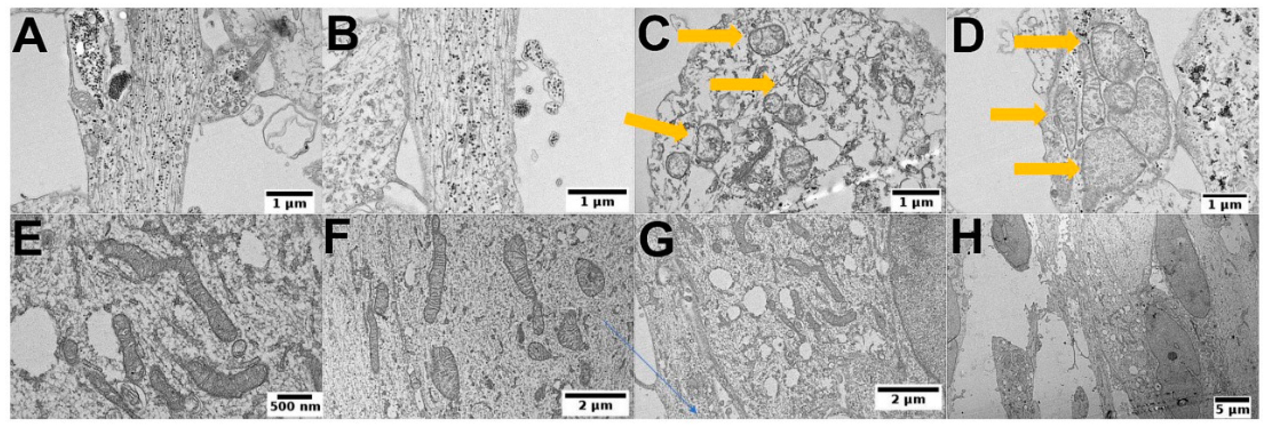 Cancers 13 02631 g008 Cancers 13 02631 g008