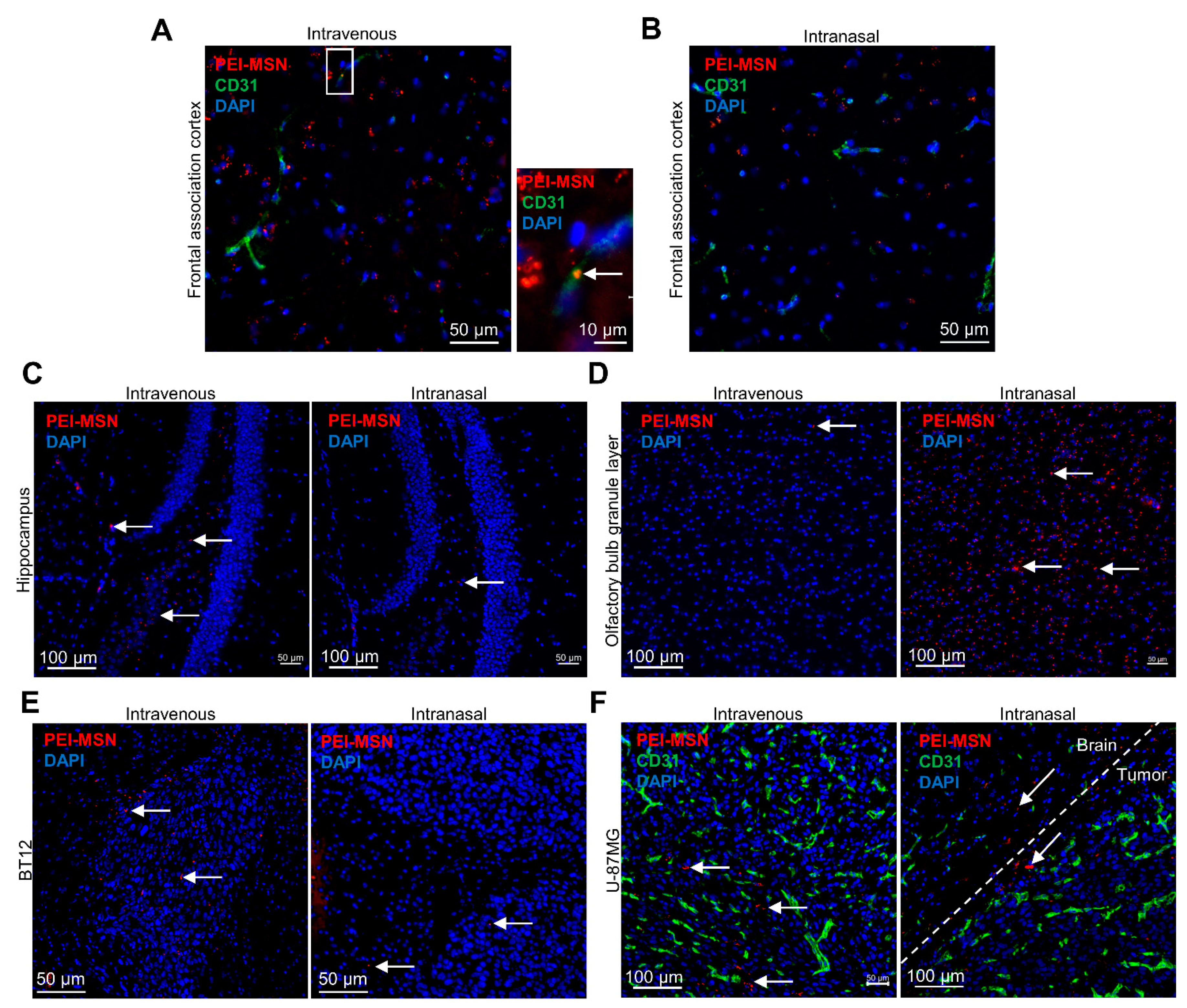 Cancers 13 02631 g010 Cancers 13 02631 g010