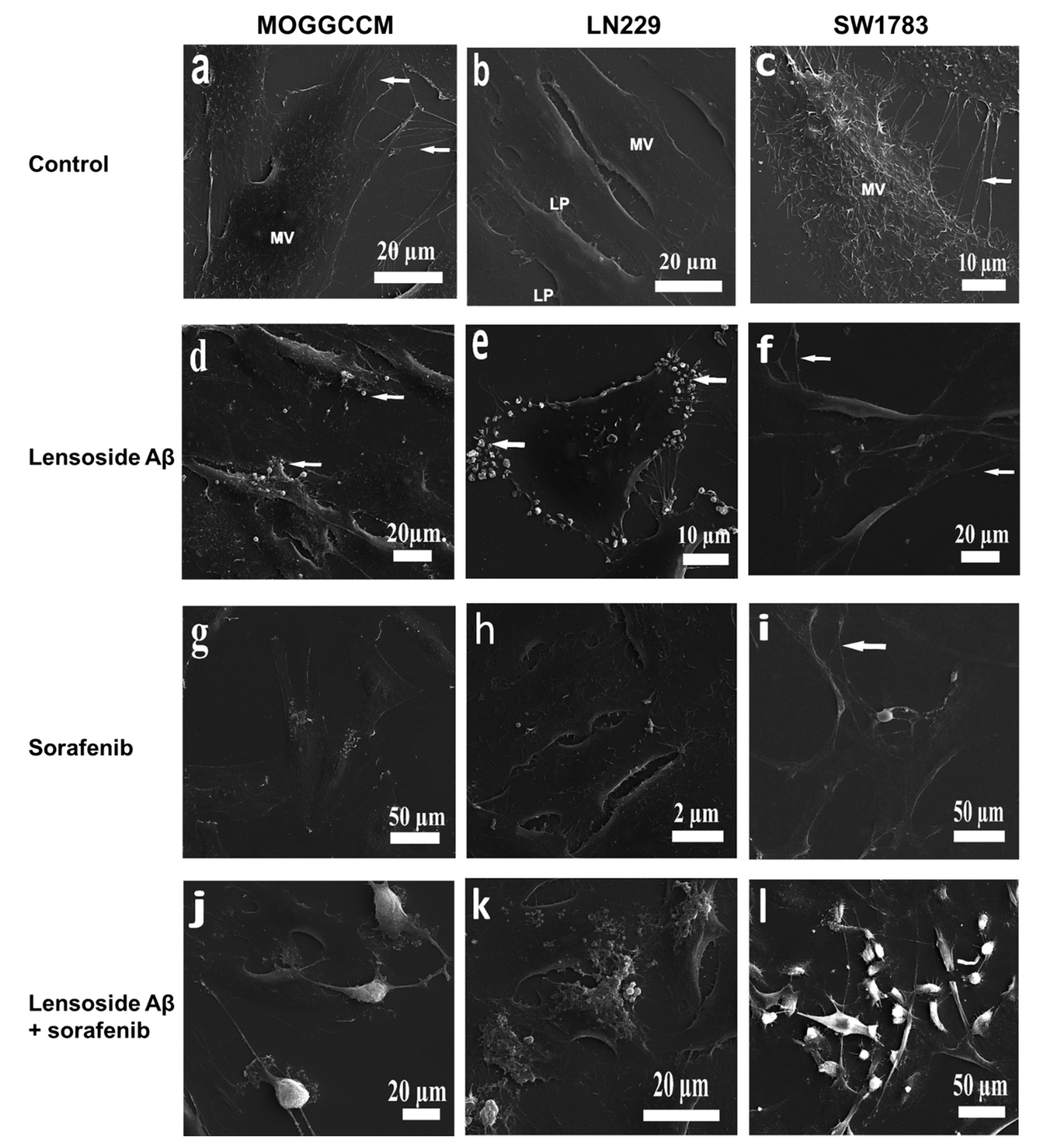 Cancers 13 02637 g009 Cancers 13 02637 g009