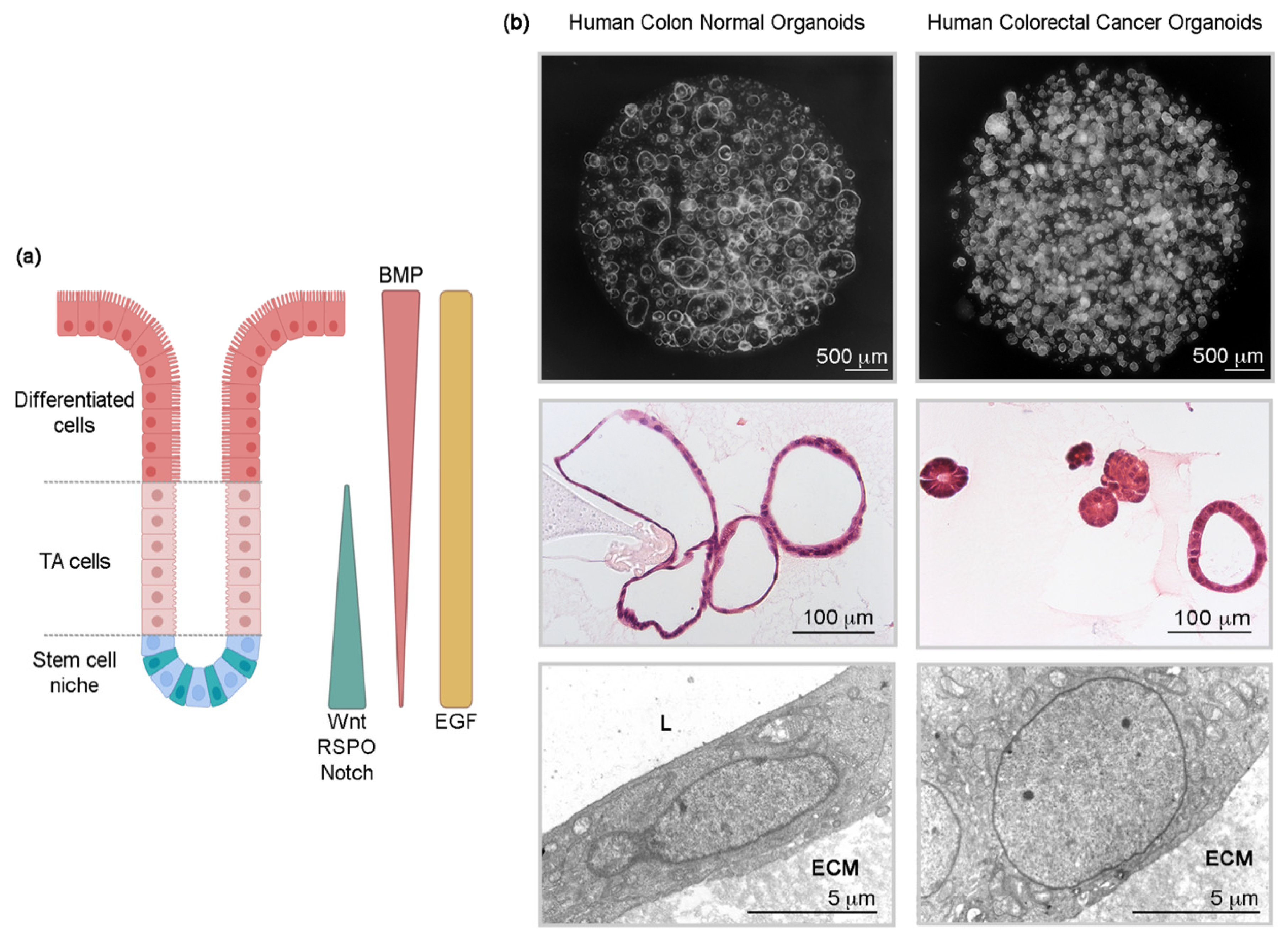 Cancer professional journal, Colorectal cancer organoids