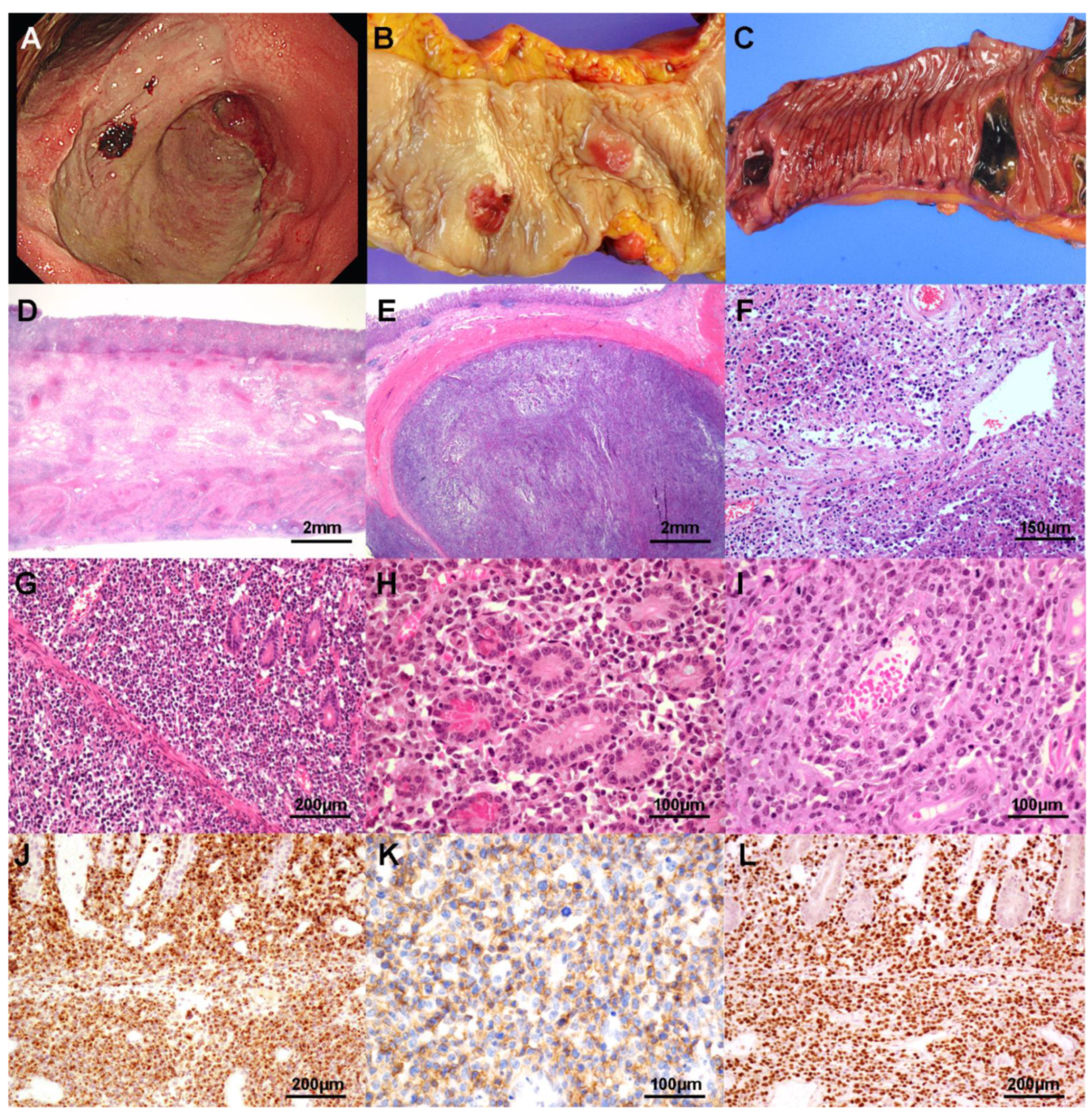 Cancers 13 02679 g001 Cancers 13 02679 g001