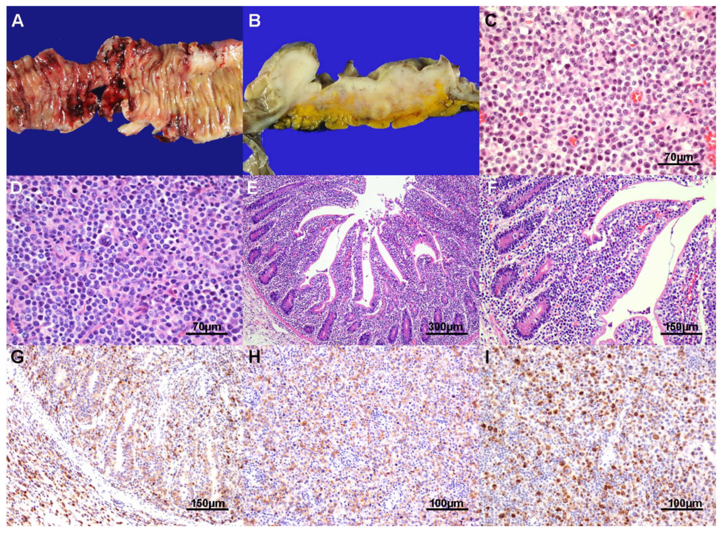 Cancers 13 02679 g002 Cancers 13 02679 g002