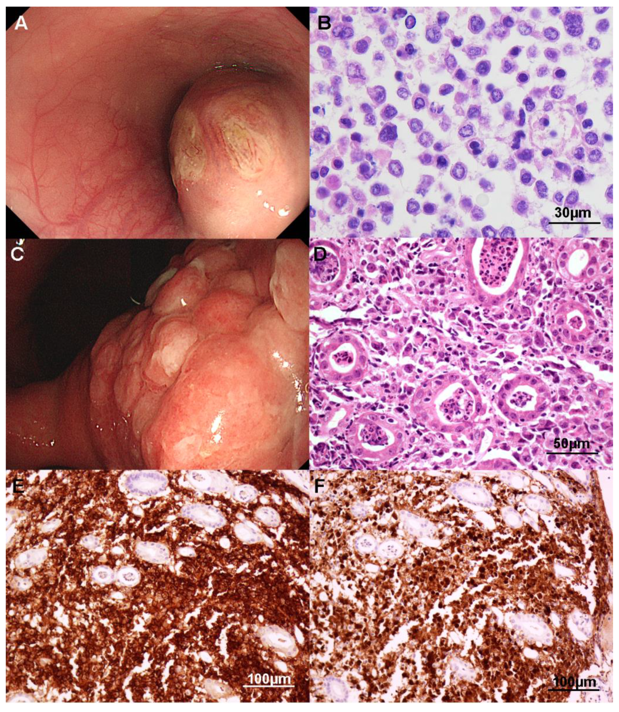 Cancers 13 02679 g004 Cancers 13 02679 g004