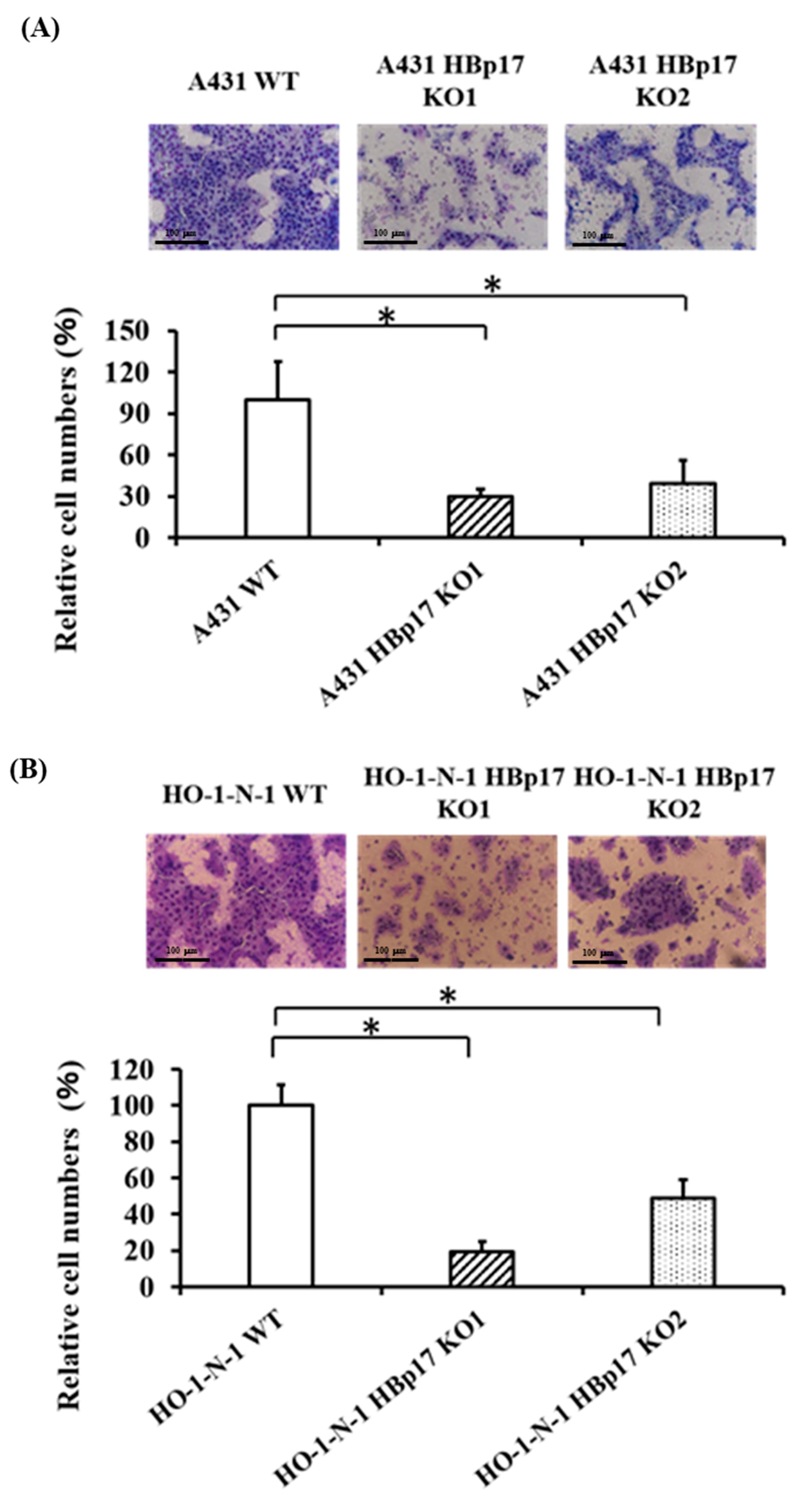 Cancers 13 02684 g004 Cancers 13 02684 g004