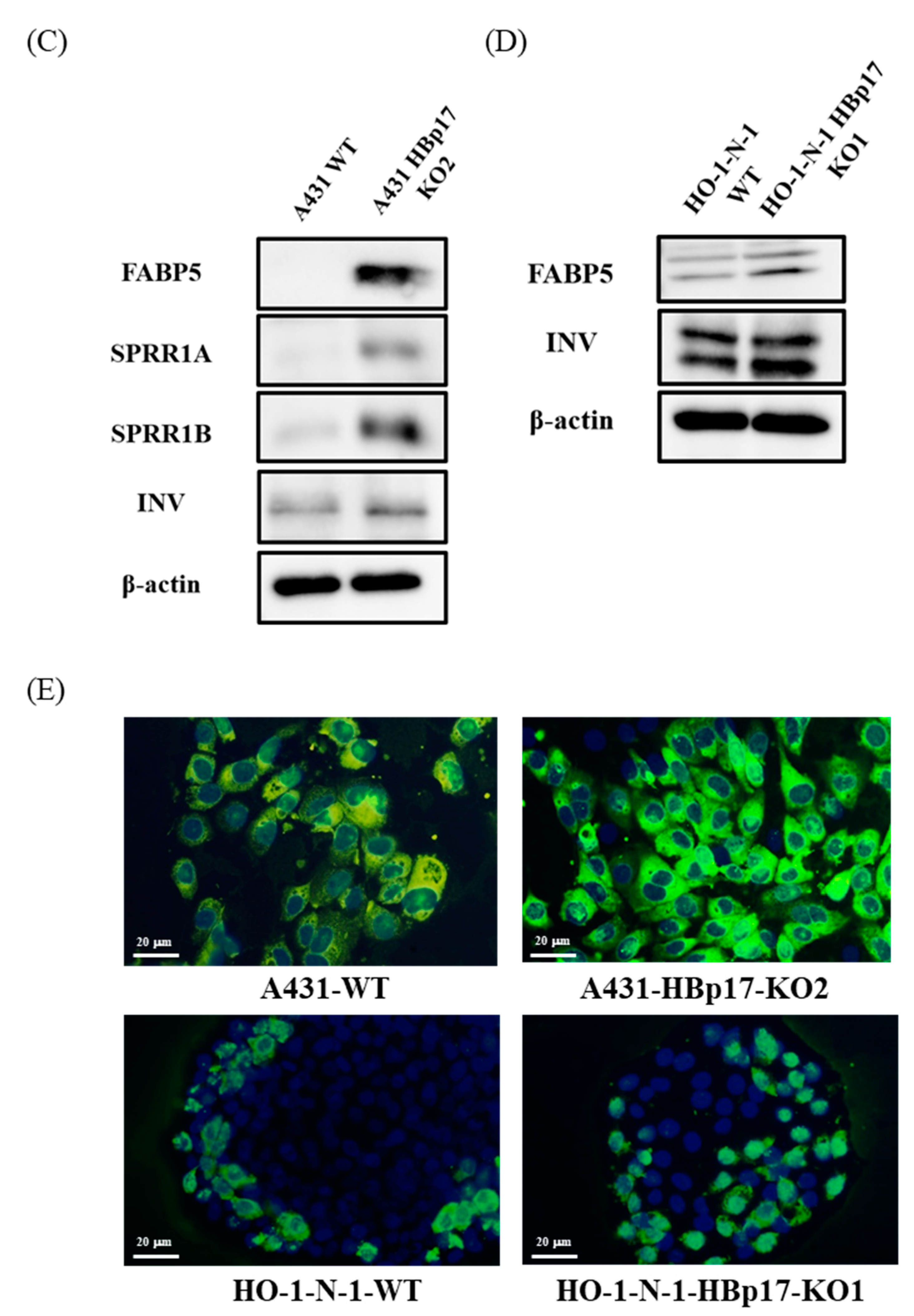 Cancers 13 02684 g007b Cancers 13 02684 g007b