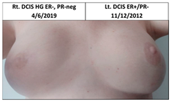 Cancers 13 02694 i001