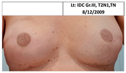 Cancers 13 02694 i004