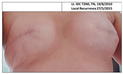 Cancers 13 02694 i005