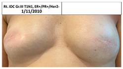 Cancers 13 02694 i006