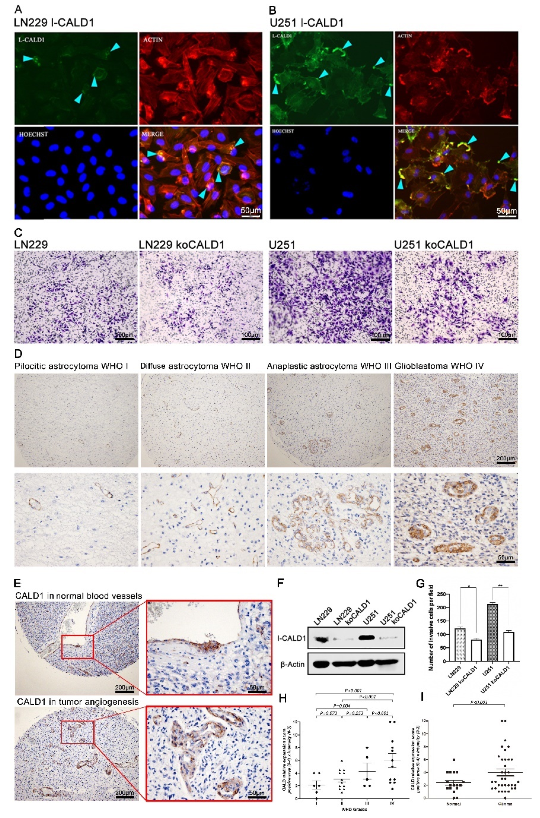 Cancers 13 02705 g004