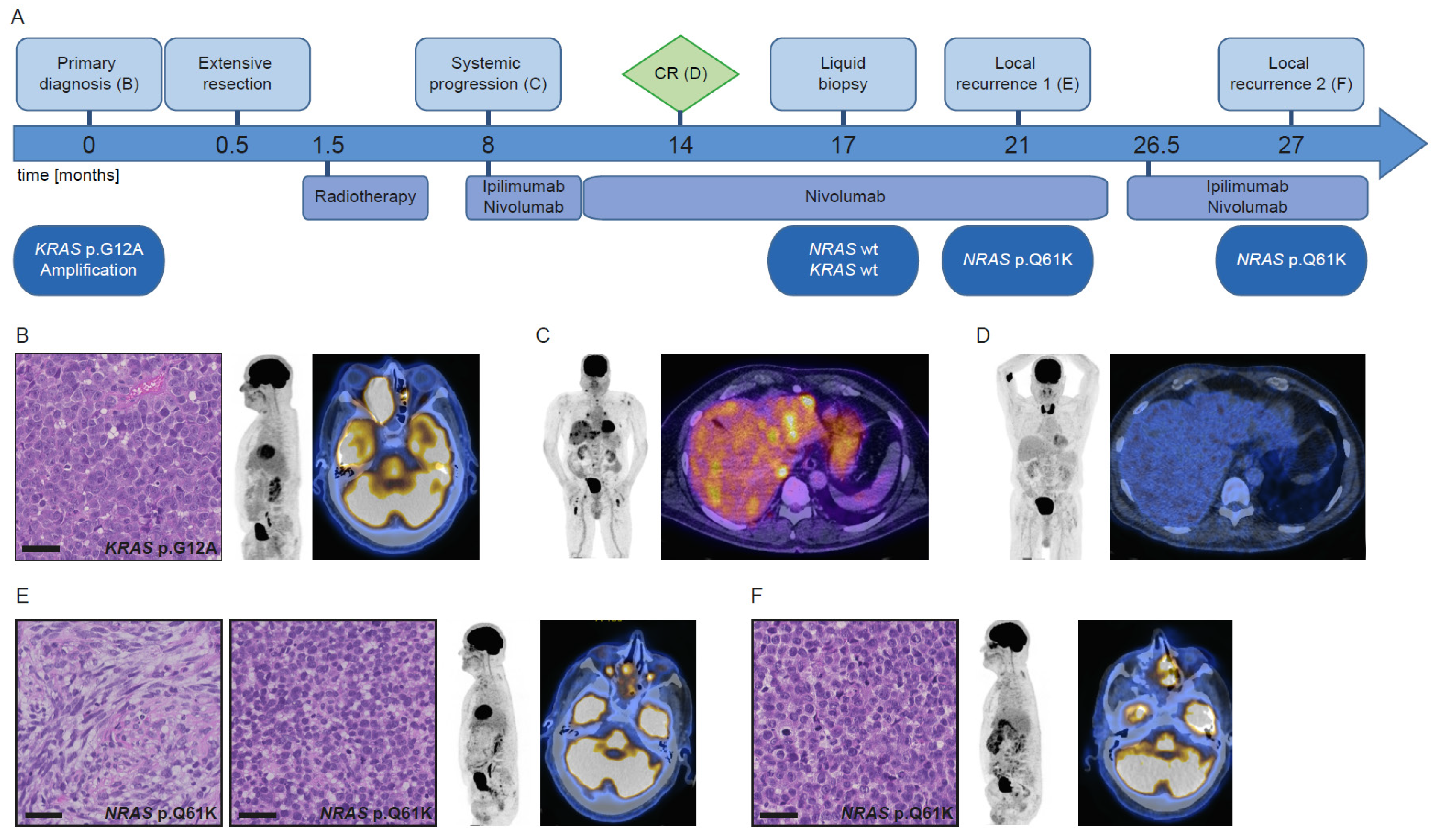 Cancers 13 02725 g002 Cancers 13 02725 g002