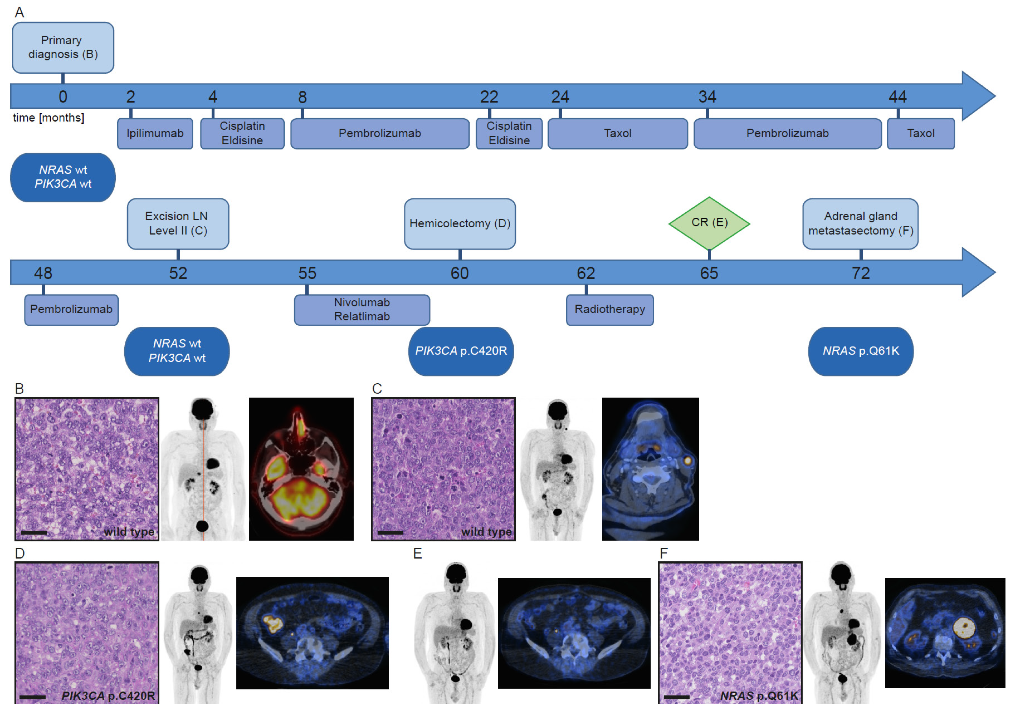 Cancers 13 02725 g003 Cancers 13 02725 g003