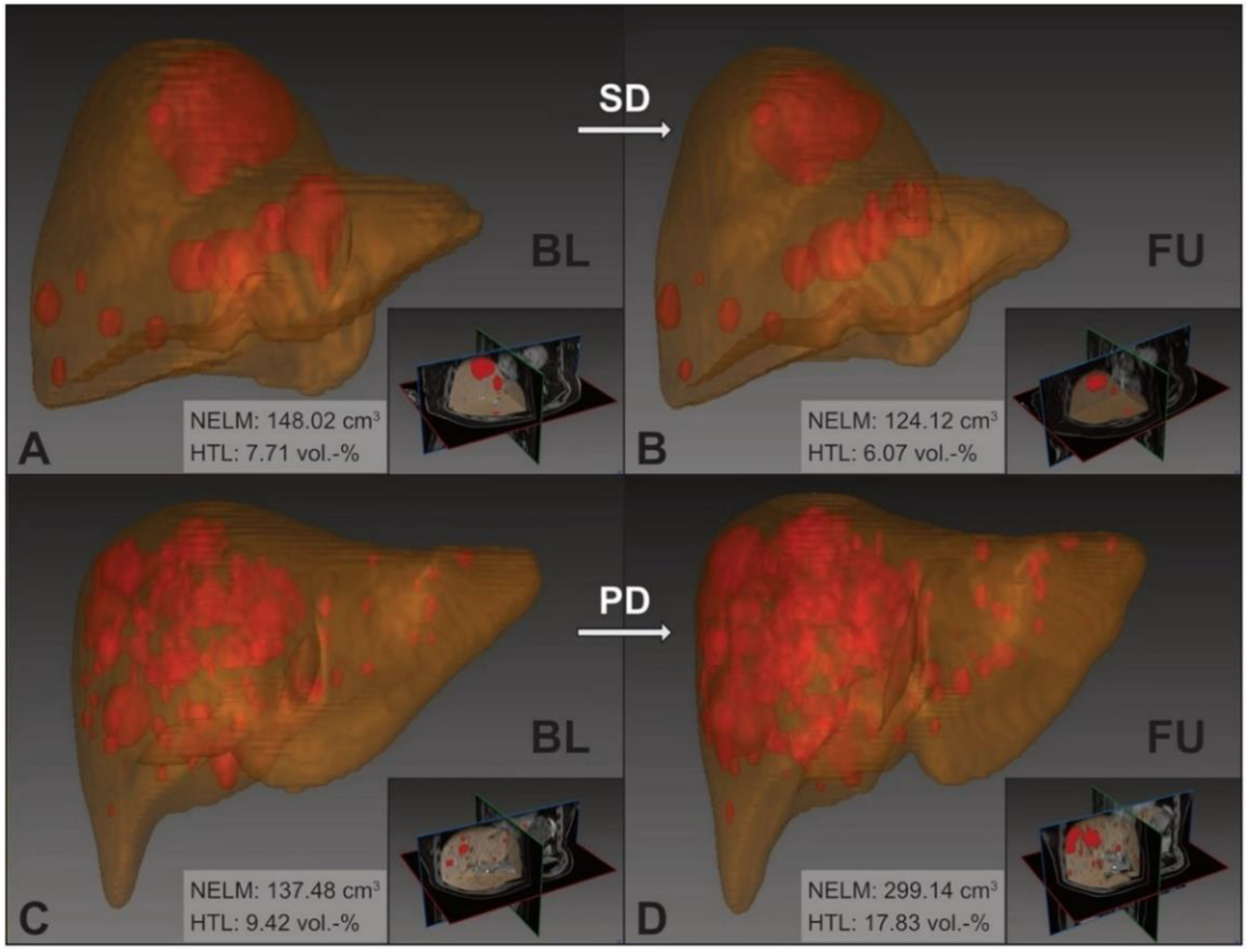 Cancers 13 02726 g002 Cancers 13 02726 g002