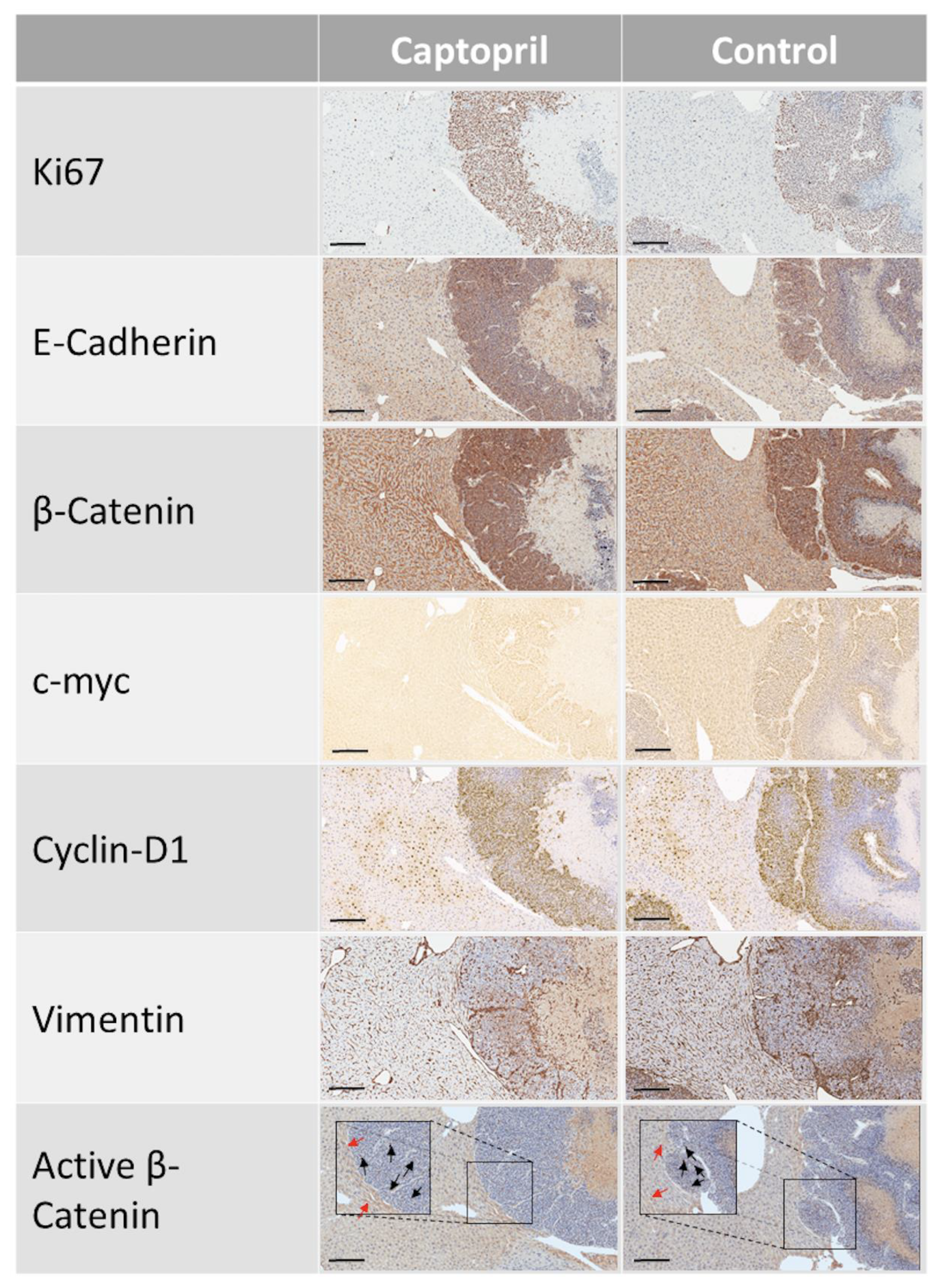 Cancers 13 02734 g003 Cancers 13 02734 g003