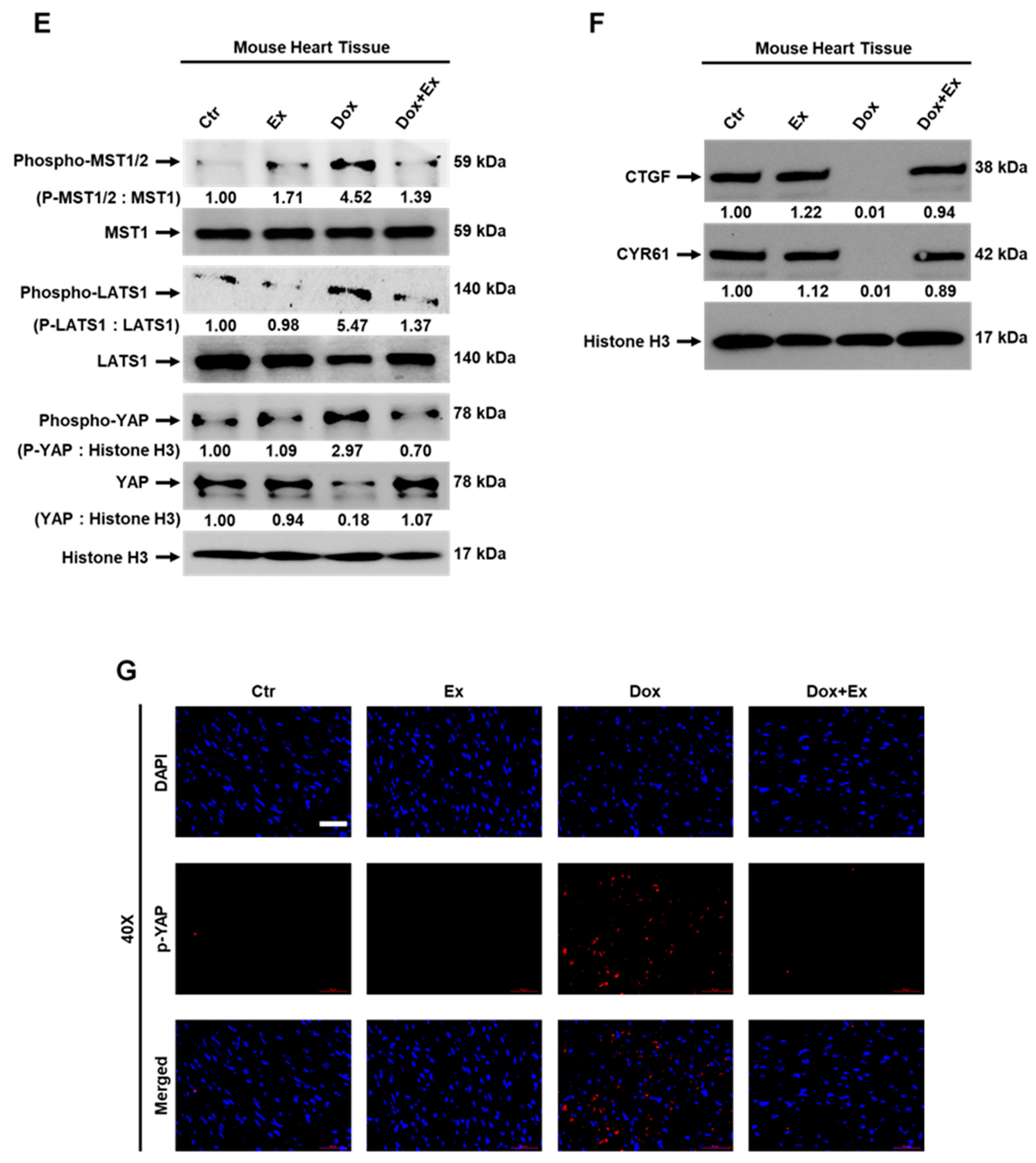 Cancers 13 02740 g008b Cancers 13 02740 g008b