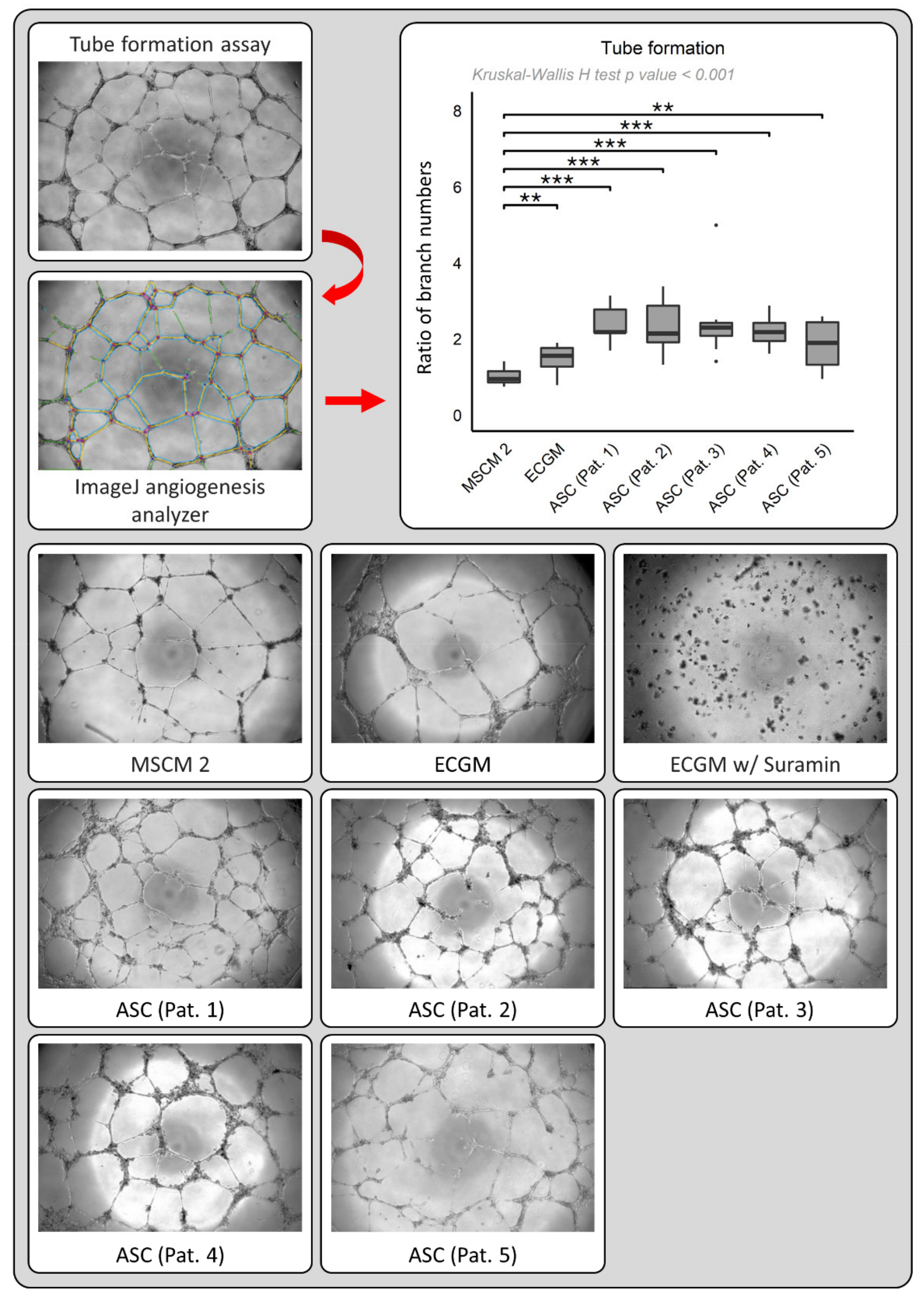 Cancers 13 02751 g004 Cancers 13 02751 g004
