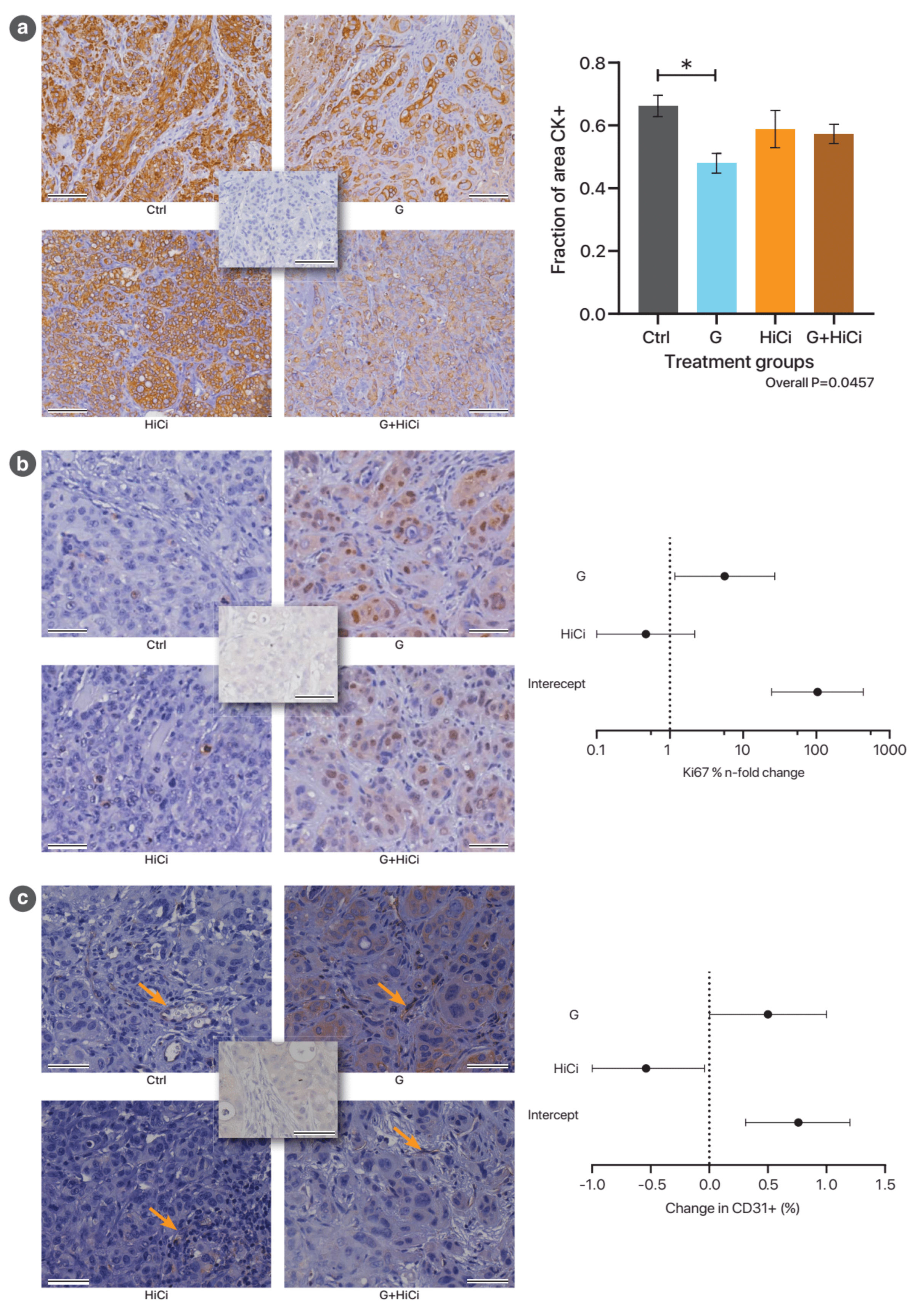 Cancers 13 02763 g002 Cancers 13 02763 g002